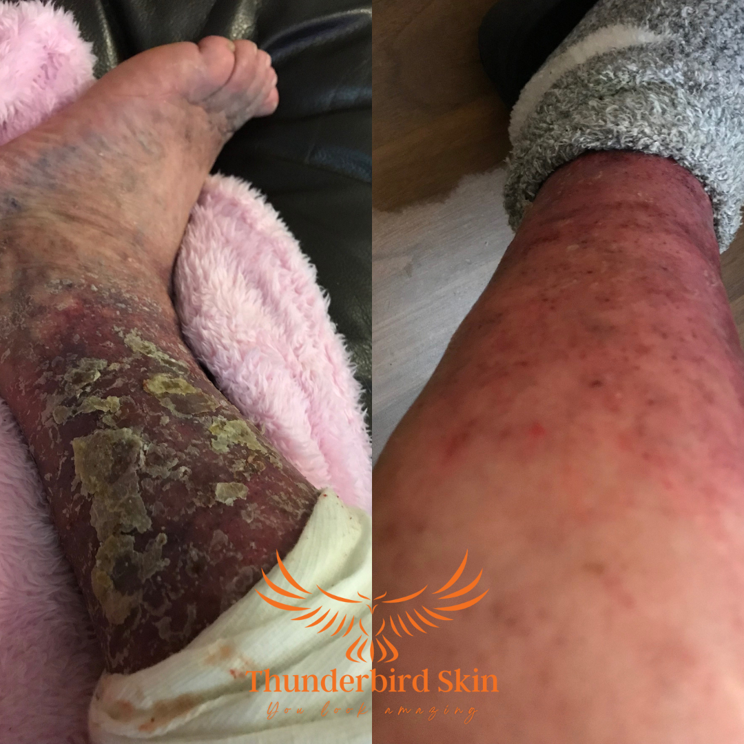 Thunderbird Natural Skincare - sensitive skin solutions Facebook ad