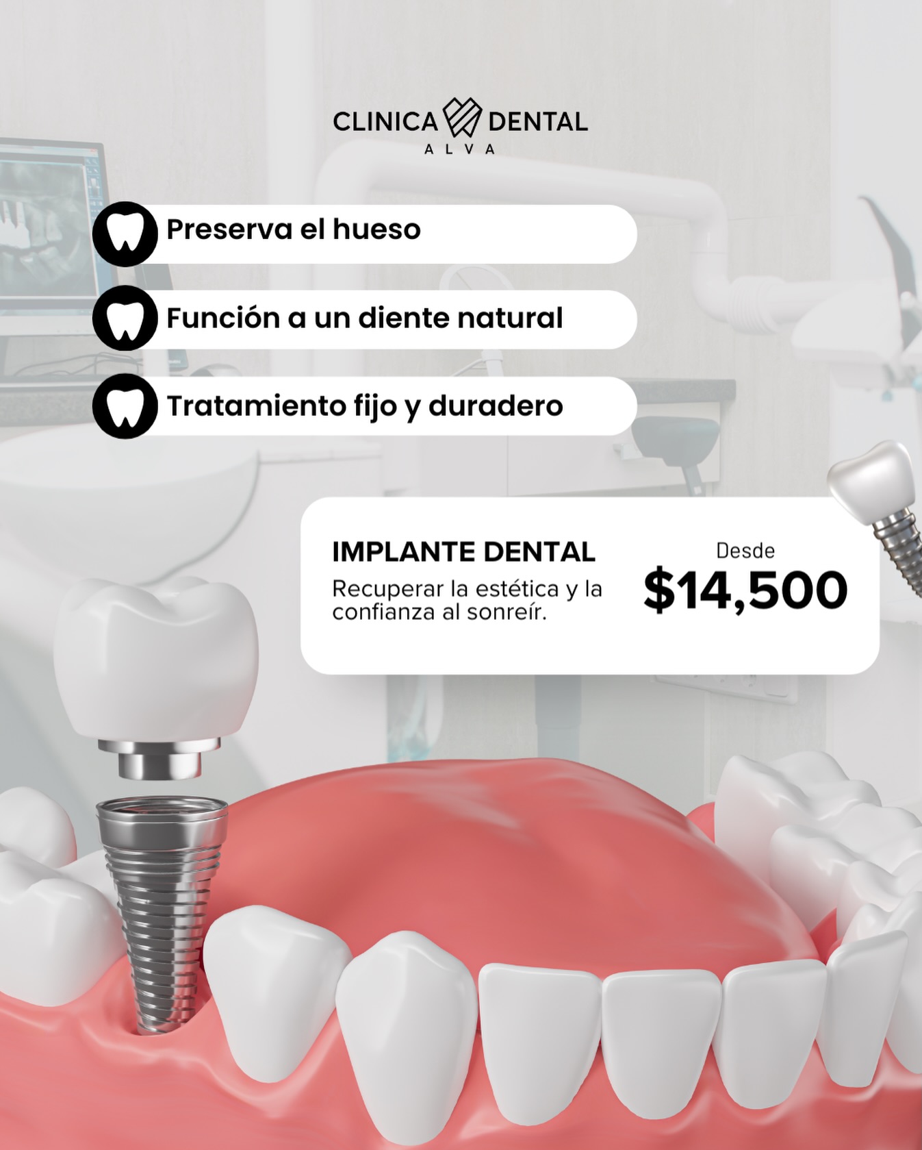 Clinica Dental ALVA Facebook ad: Implante Dental