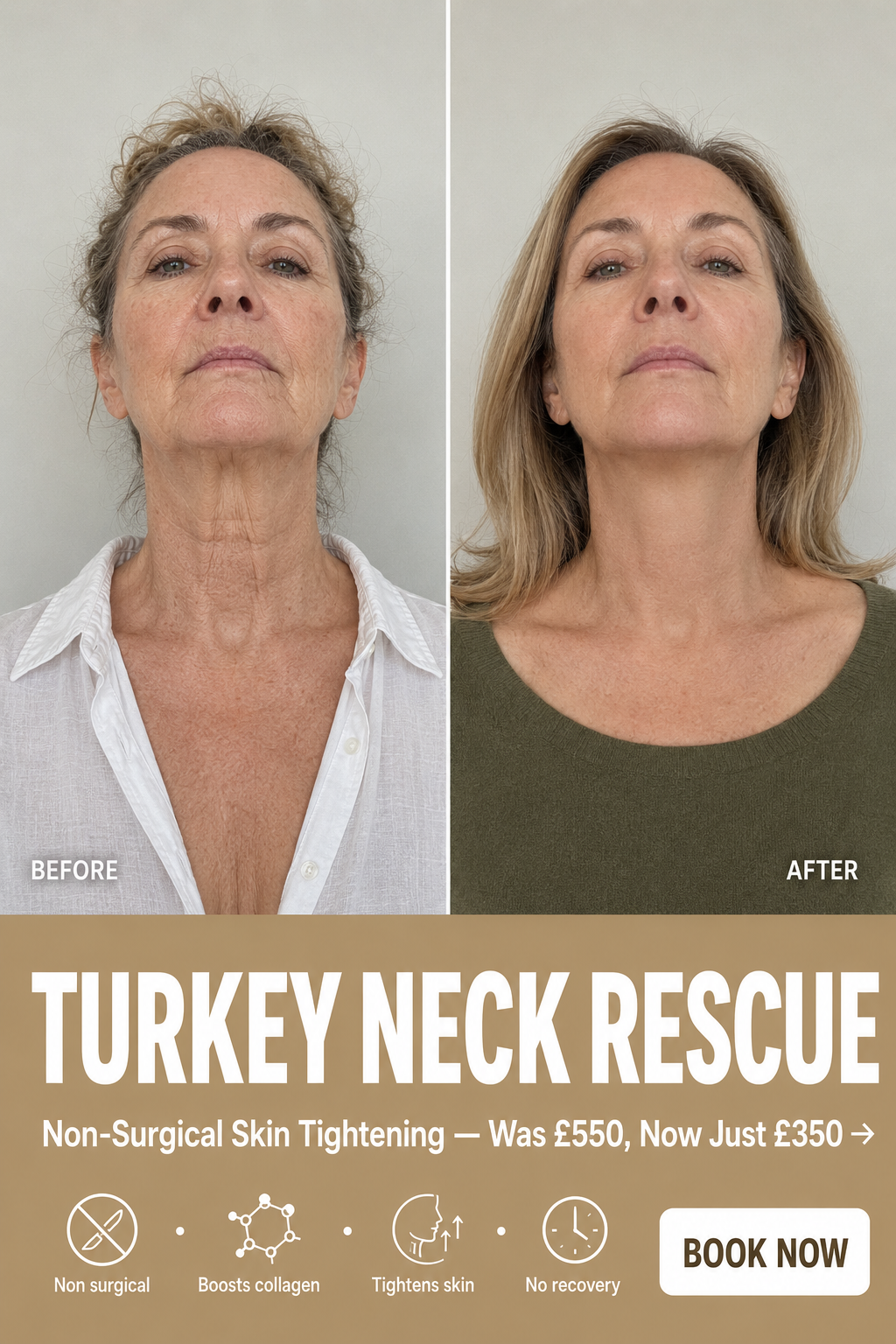 rsakskinandaesthetics Facebook ad: Non Surgical Neck Lift, Now £350 (Was £550)