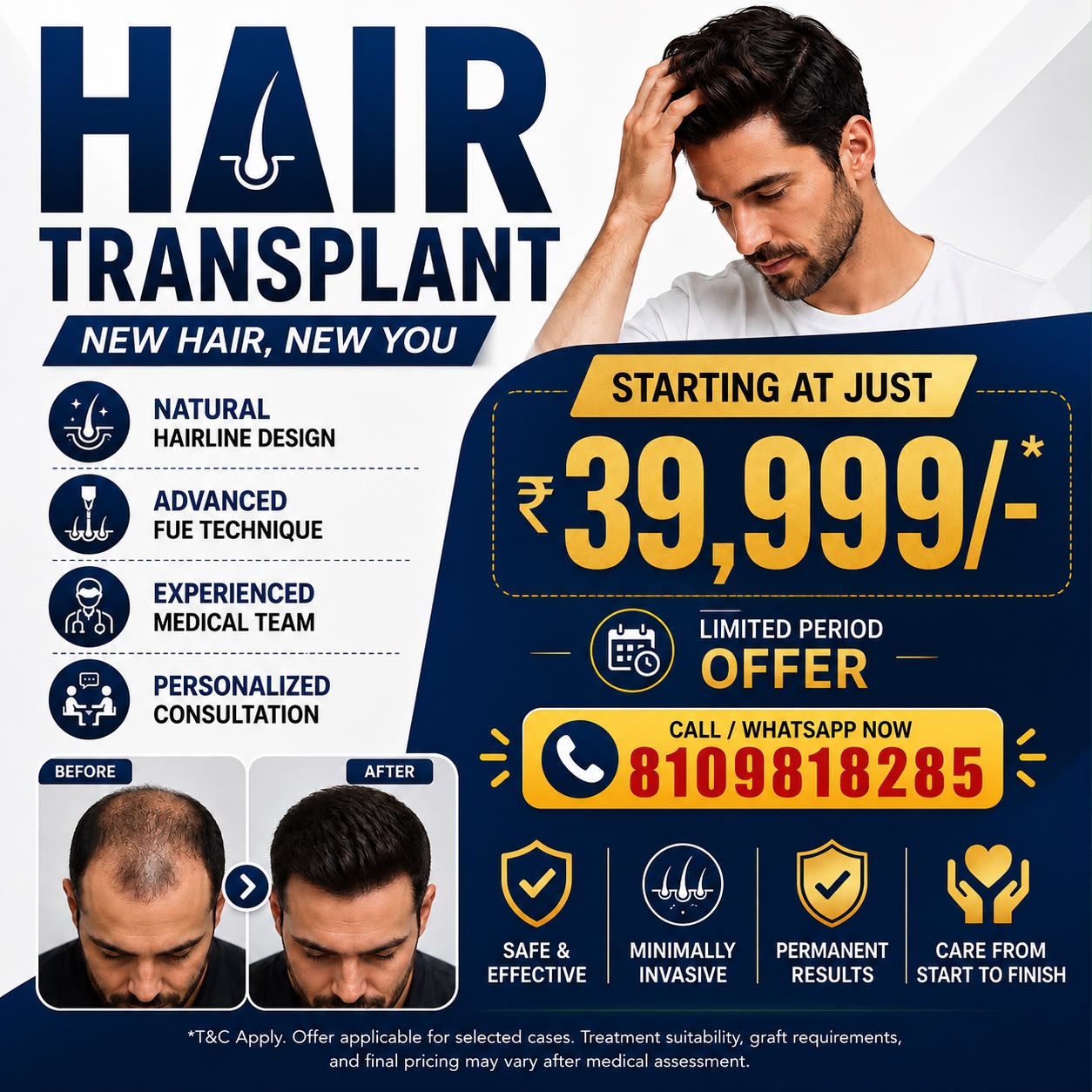 HT Cosmetic & Trauma center Facebook ad: Hair Transplant Starting at ₹39,999/-*