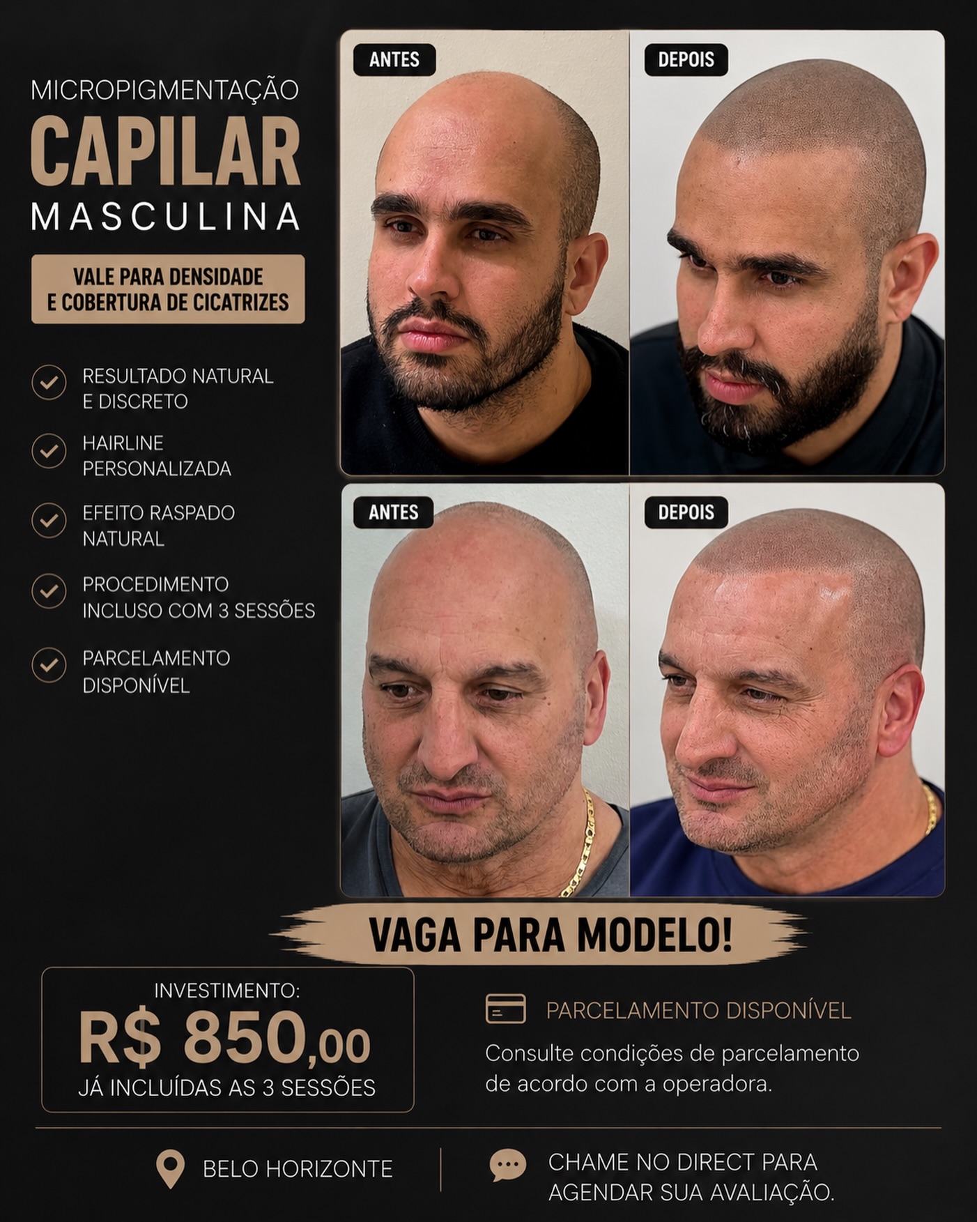 Mattos Micropigmentação capilar Facebook ad: VAGA PARA MODELO, MICROPIGMENTAÇÃO CAPILAR
