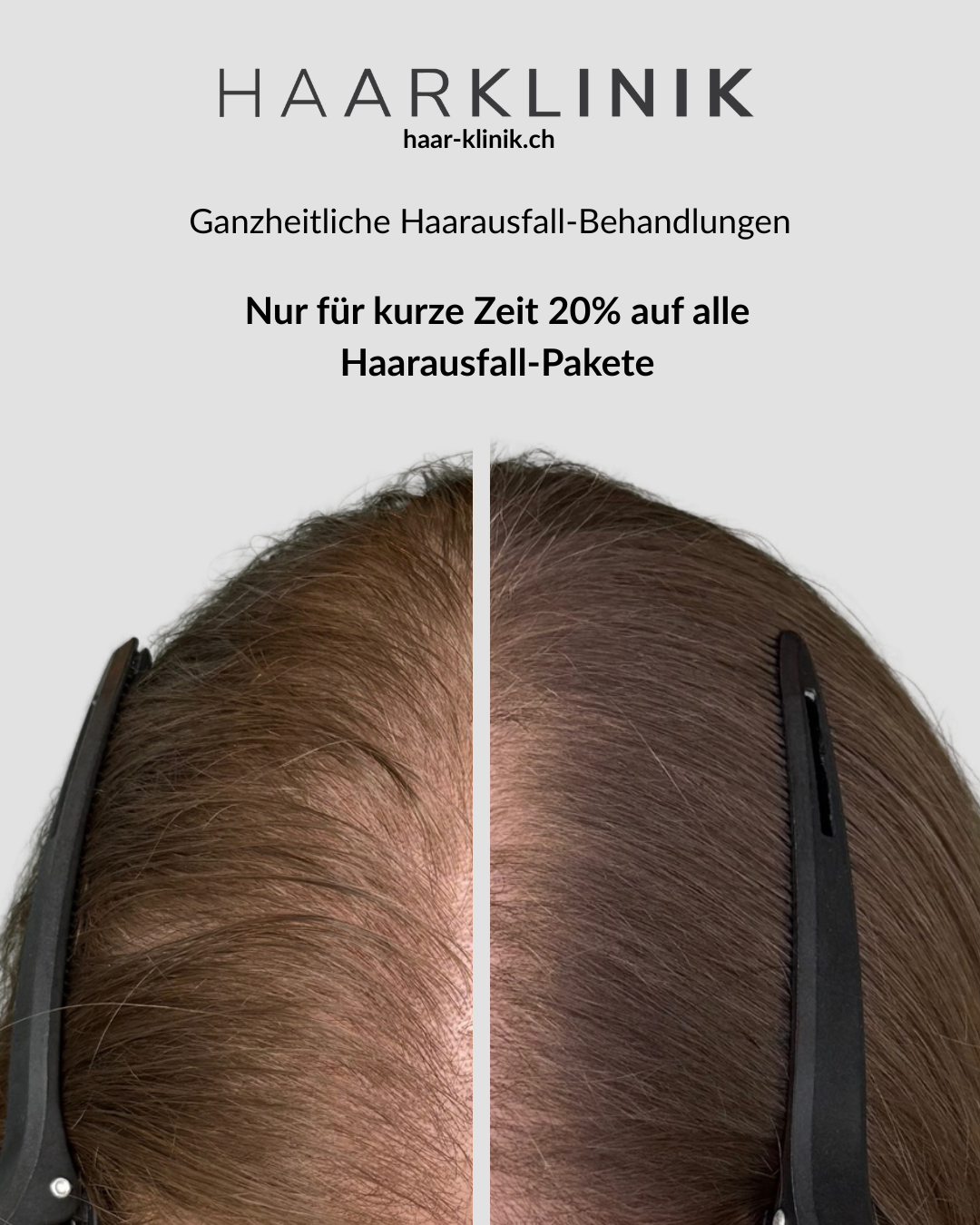 Haarklinik Facebook ad from Jul 17, 2026