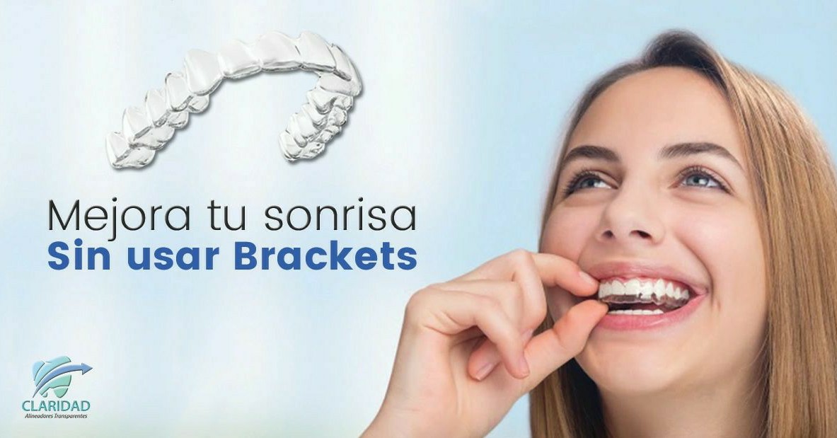 Claridad Alineadores Transparentes Facebook ad