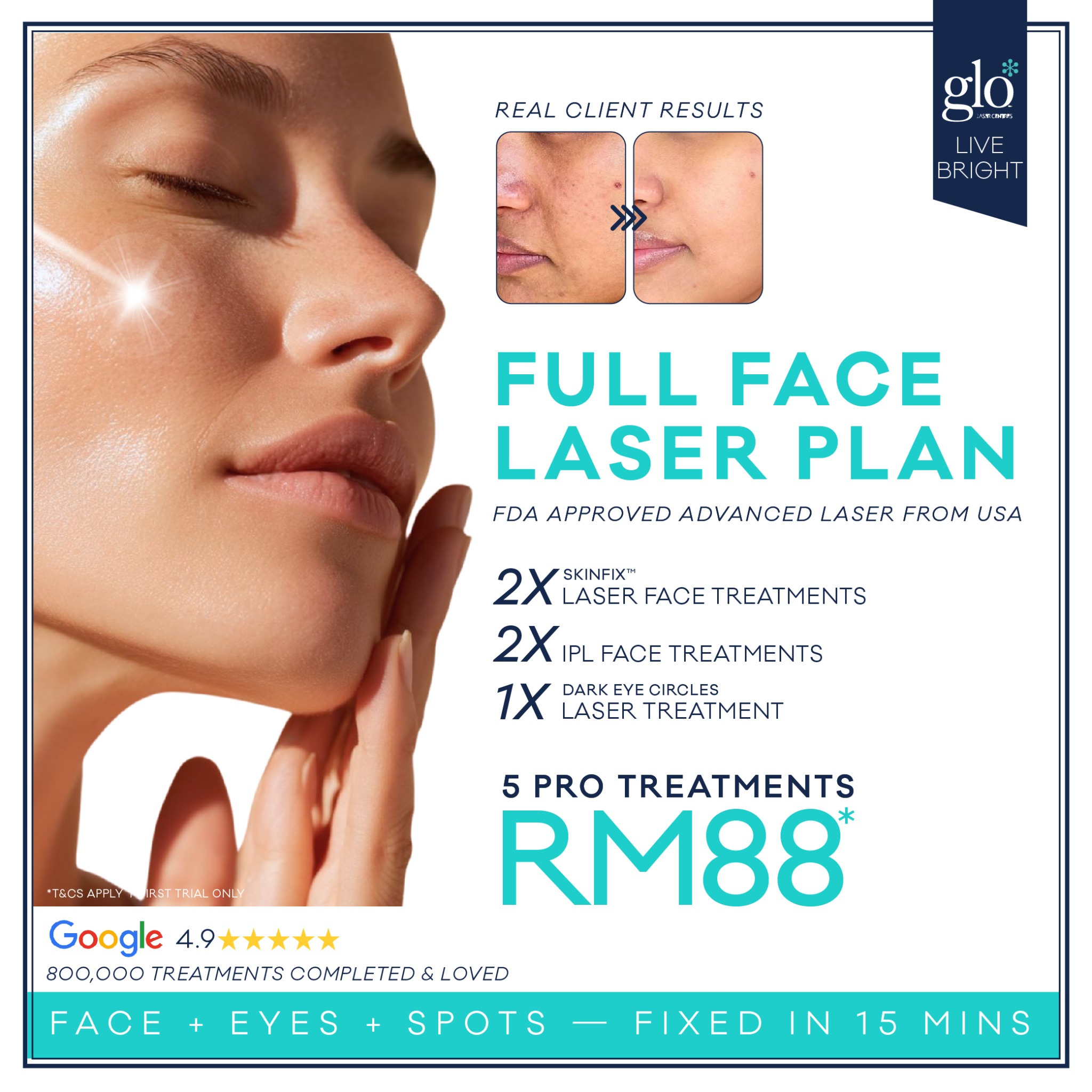 Glo Laser Centres Facebook ad