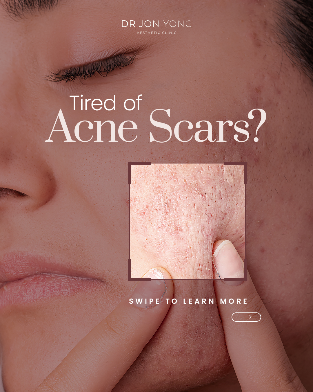 Dr Jon Yong Aesthetic Clinic Facebook ad