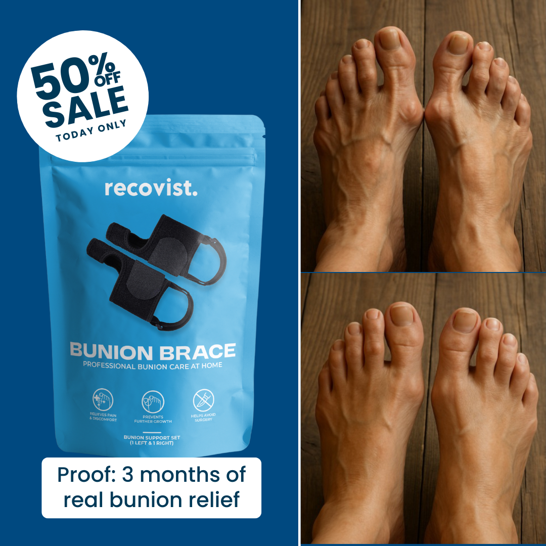 Recovist Facebook ad