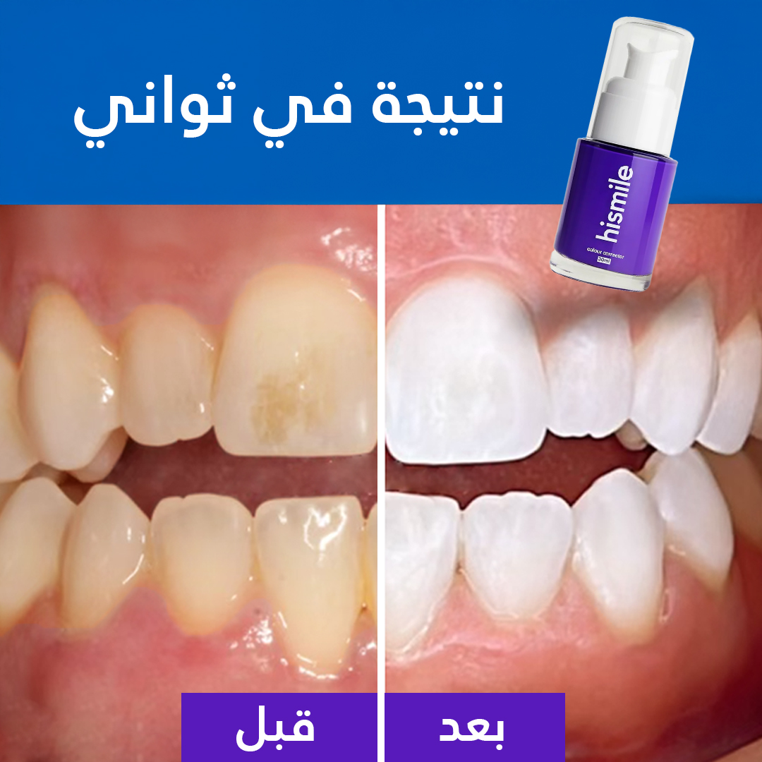 Hismile Facebook ad
