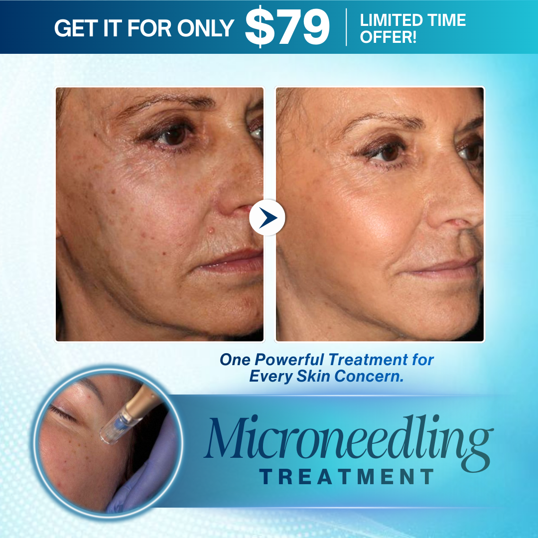 I Love Skin Treatments Facebook ad