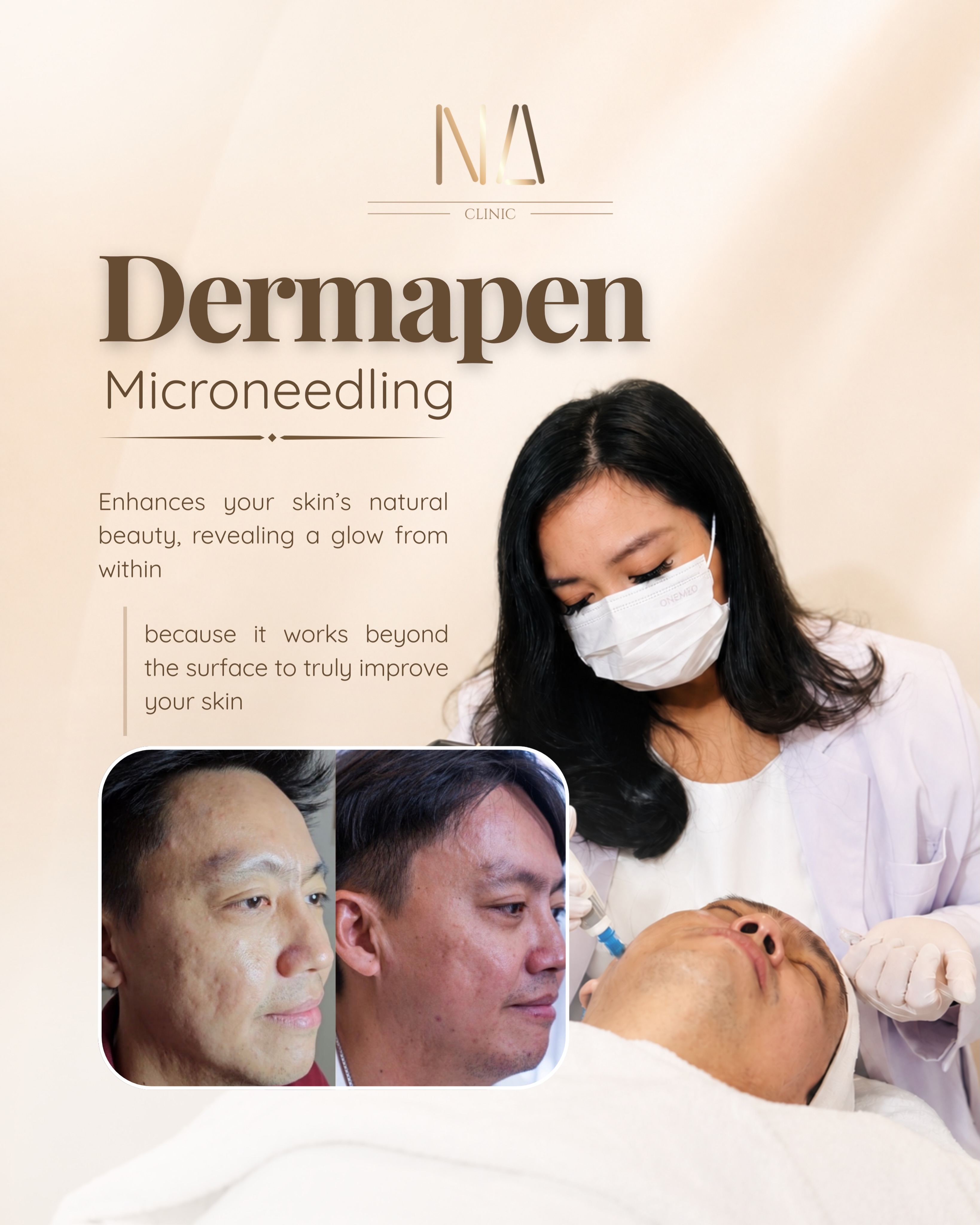 NA Clinic Renon Facebook ad