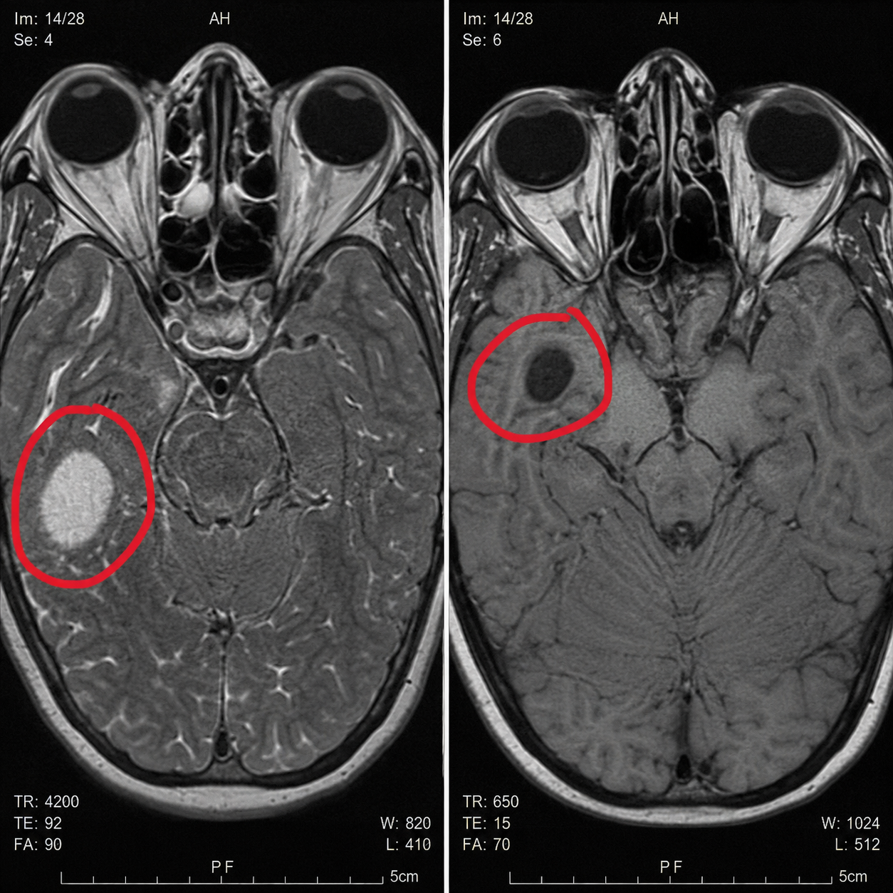 Health & Science Journal Facebook ad: Read This If Your Fibro Won't Budge