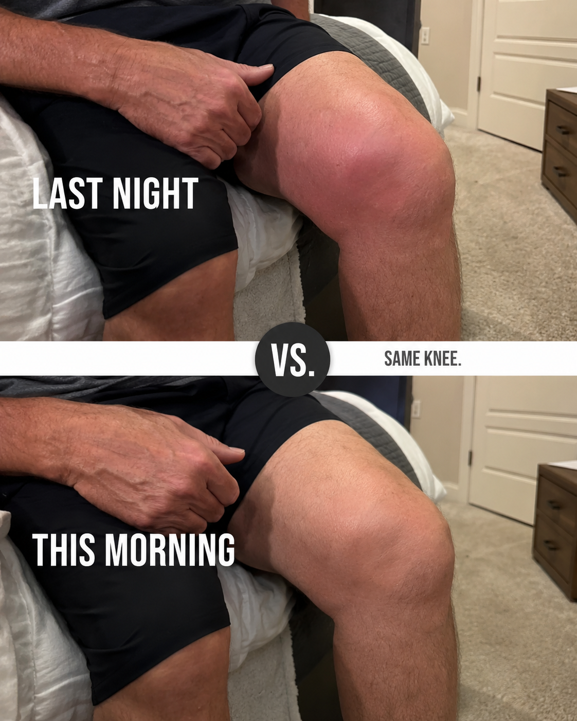 Linda Baker Facebook ad: 12 years of bone-on-bone knee pain gone in 2 days?
