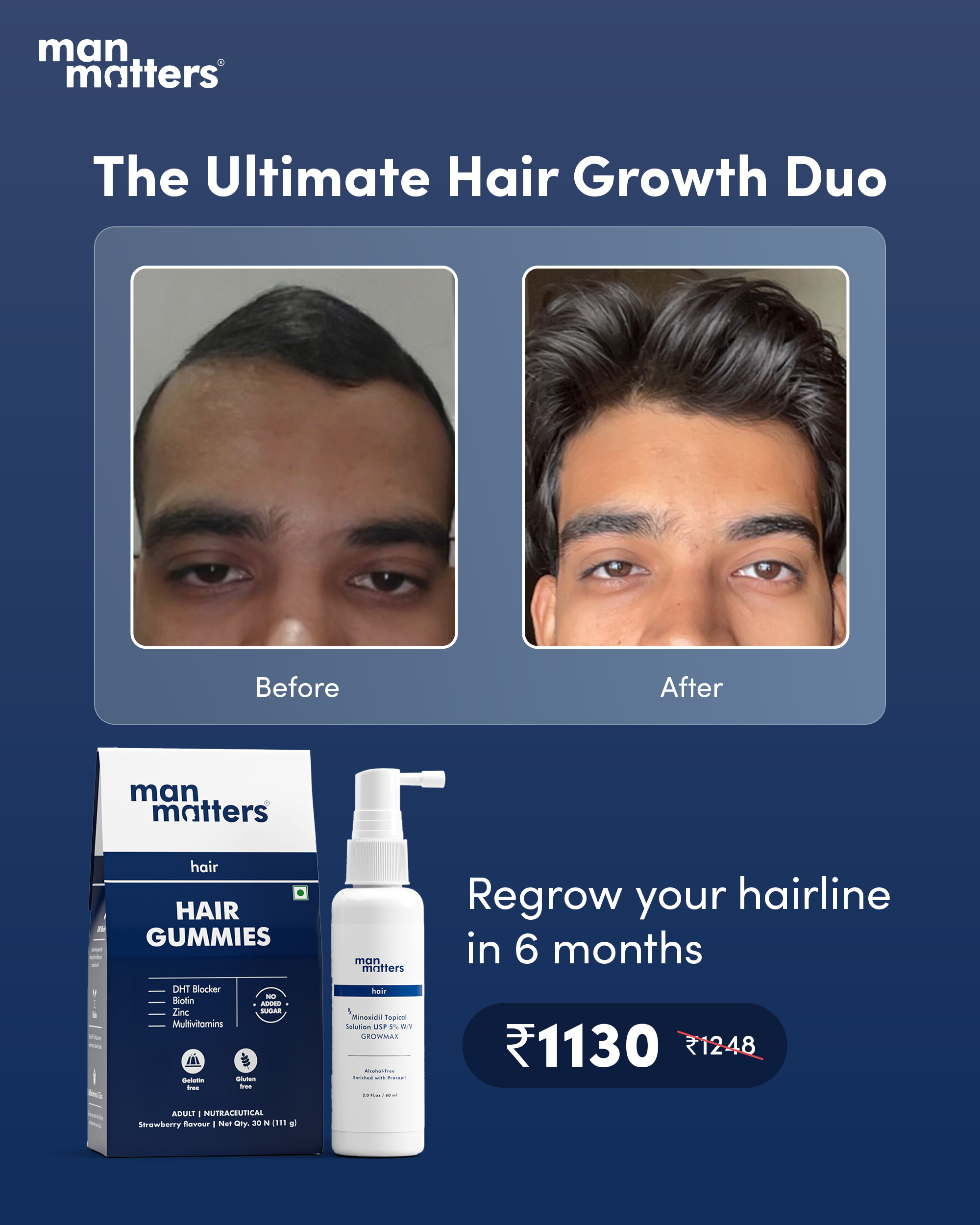 Hair Matters by Man Matters Facebook ad