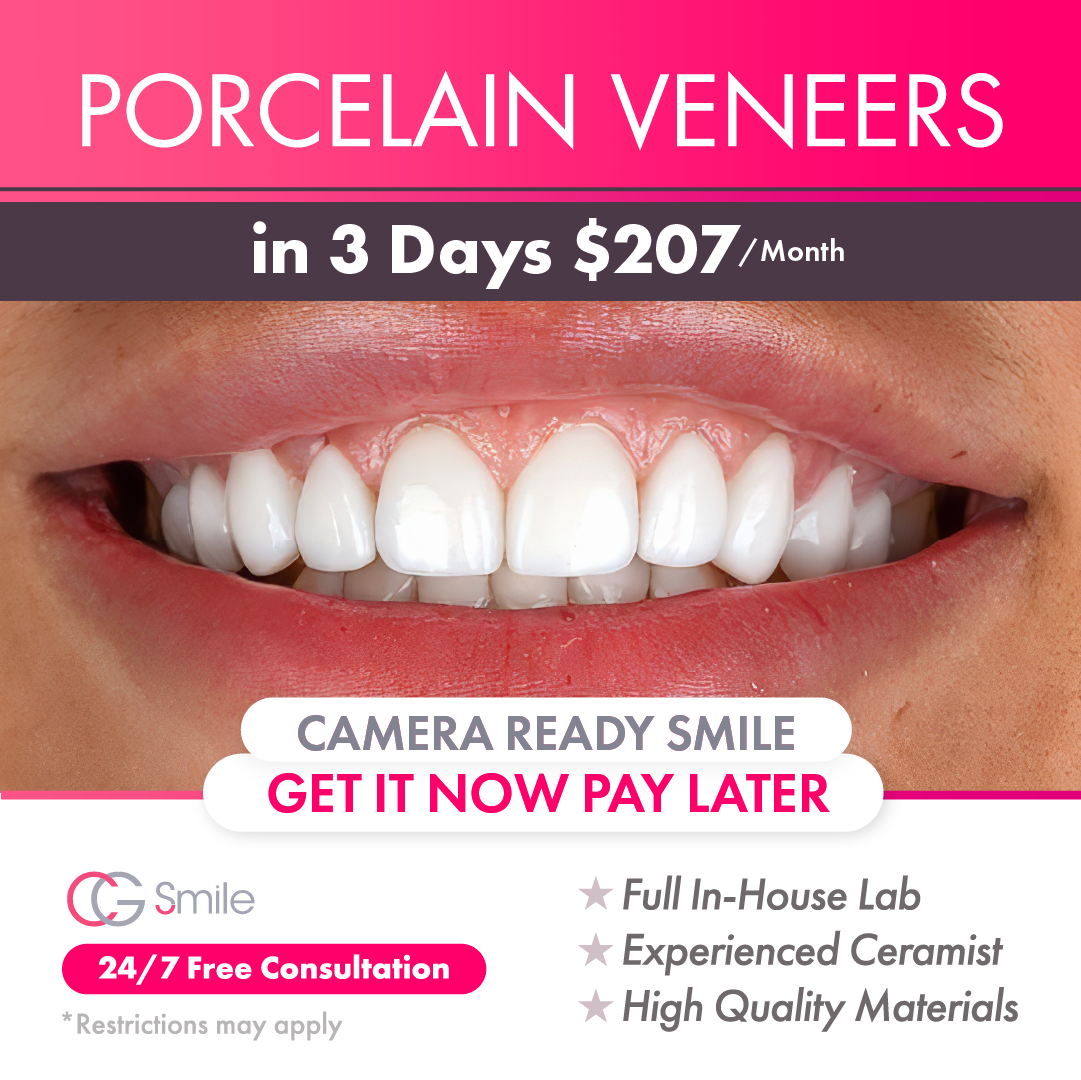 CG Smile Facebook ad