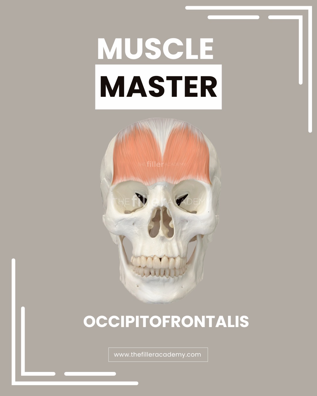 The Filler Academy Facebook ad: The Frontalis muscle, the key player in upper…
