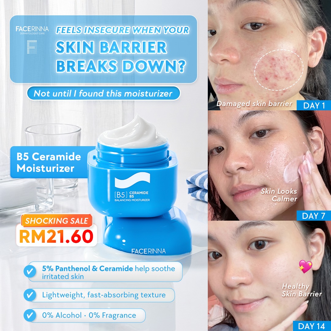 Facerinna Official Facebook ad