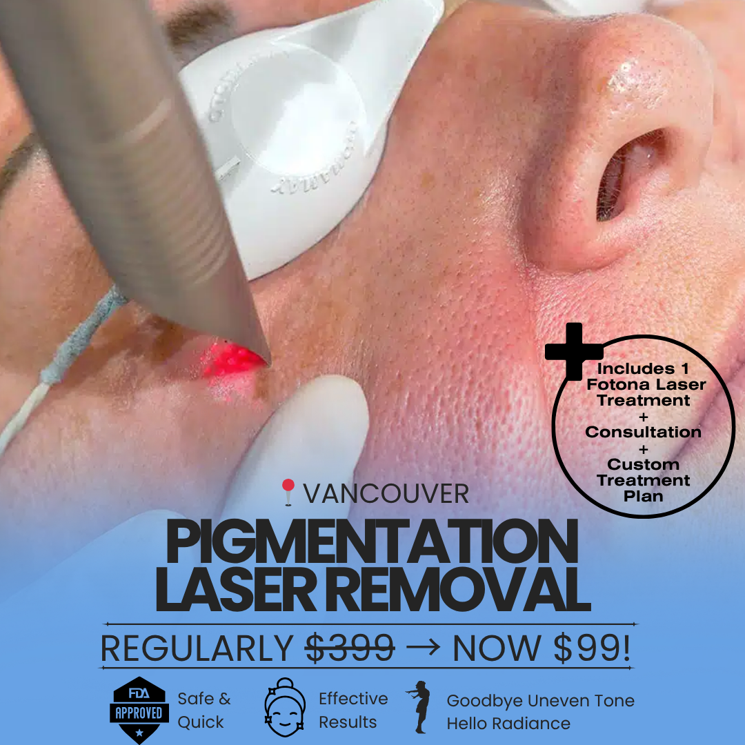 GraceMed Esthetics & Wellness Inc. Facebook ad: Gracemed Pigmentation Laser Removal Now $99!