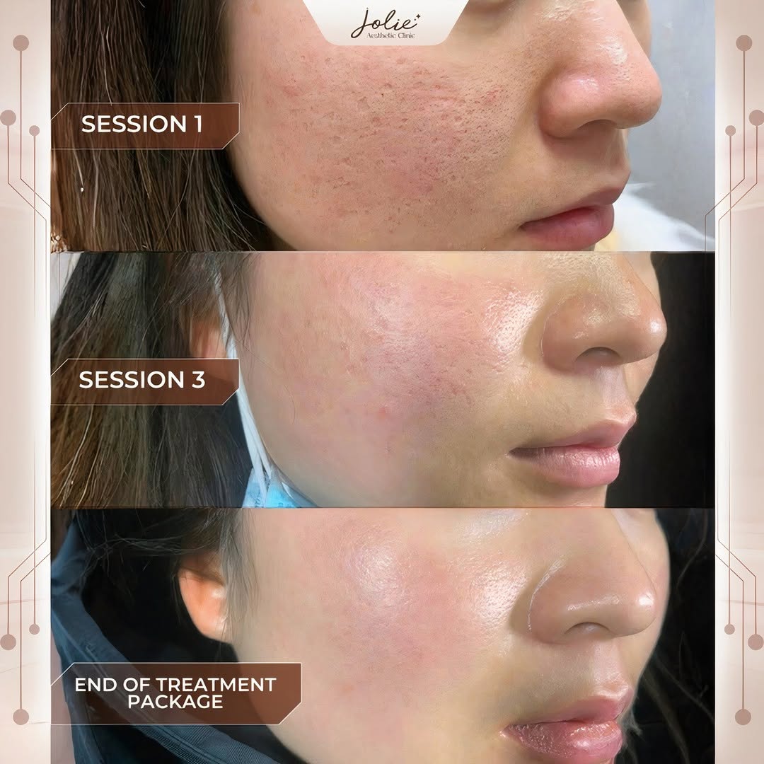 Jolie Perfect SkinM1 Facebook ad