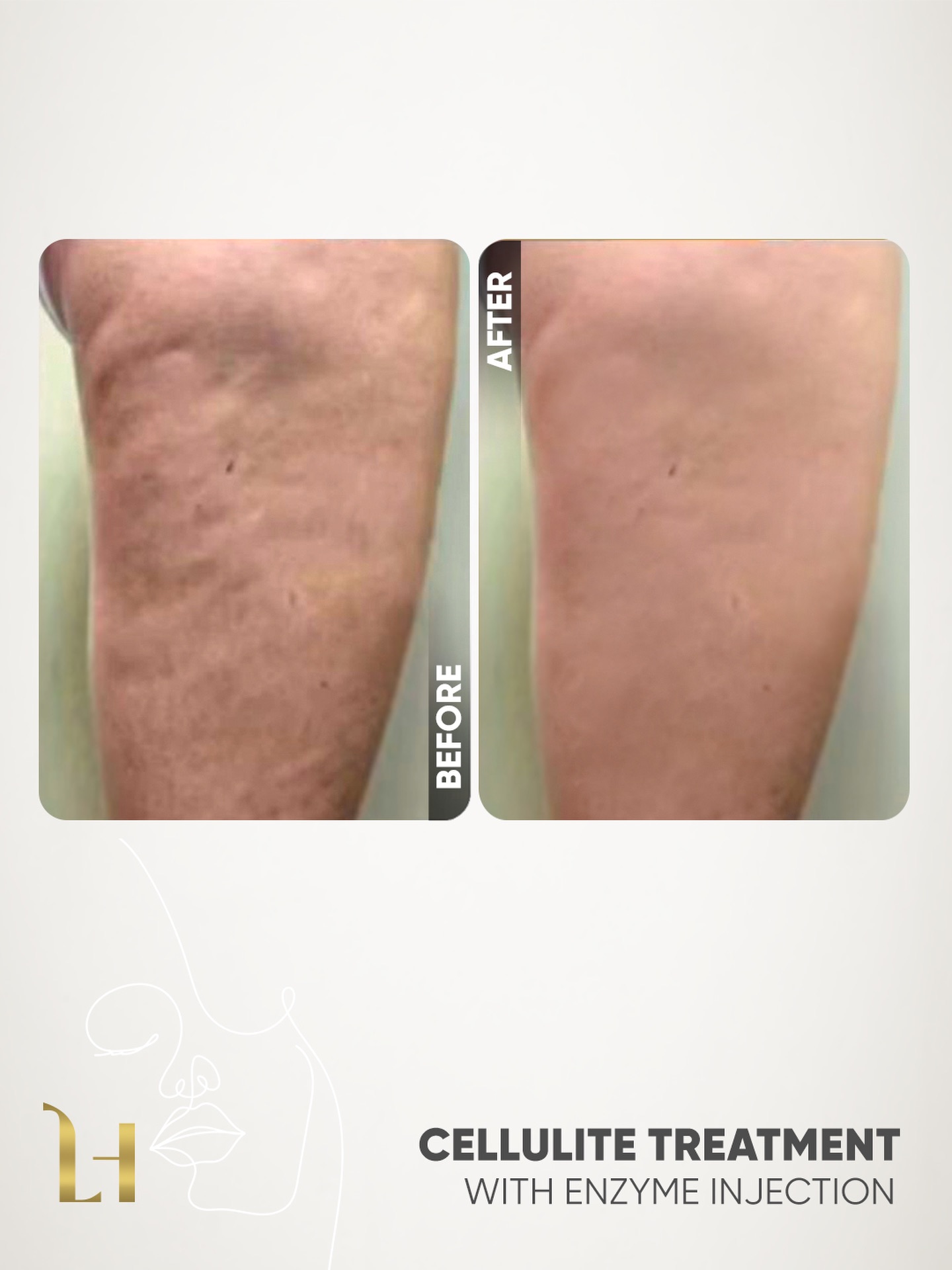 Dr. Lama Hussein Facebook ad