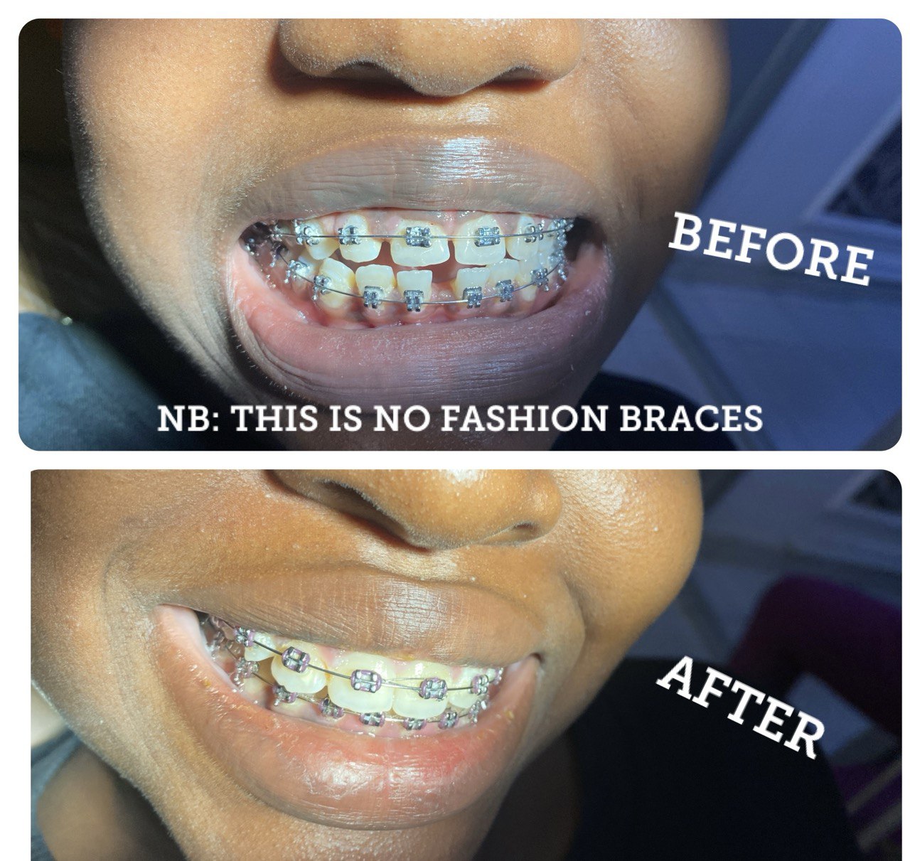 Reach Dental Orthodontics. Facebook ad