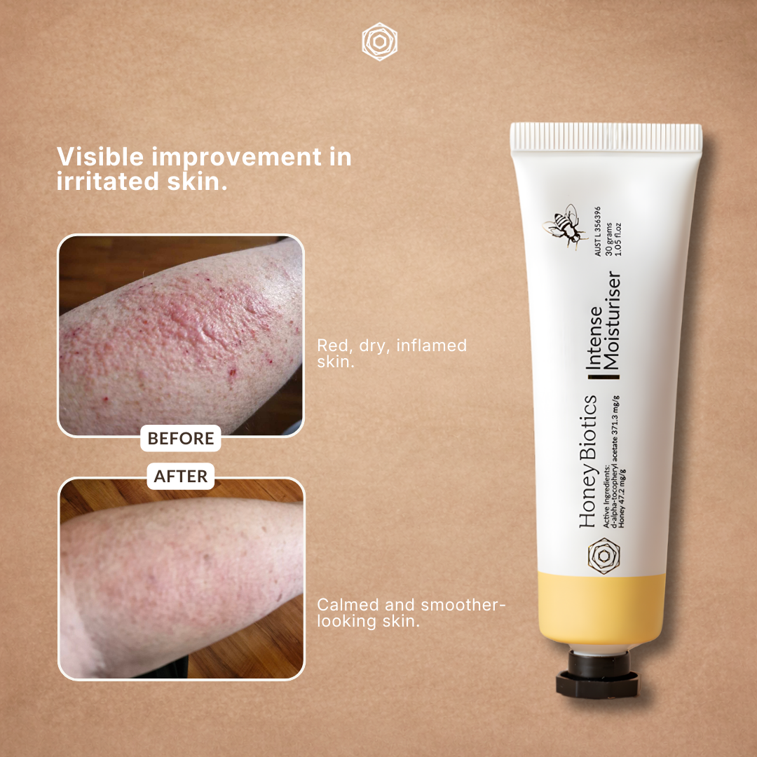 Honey Biotics Facebook ad