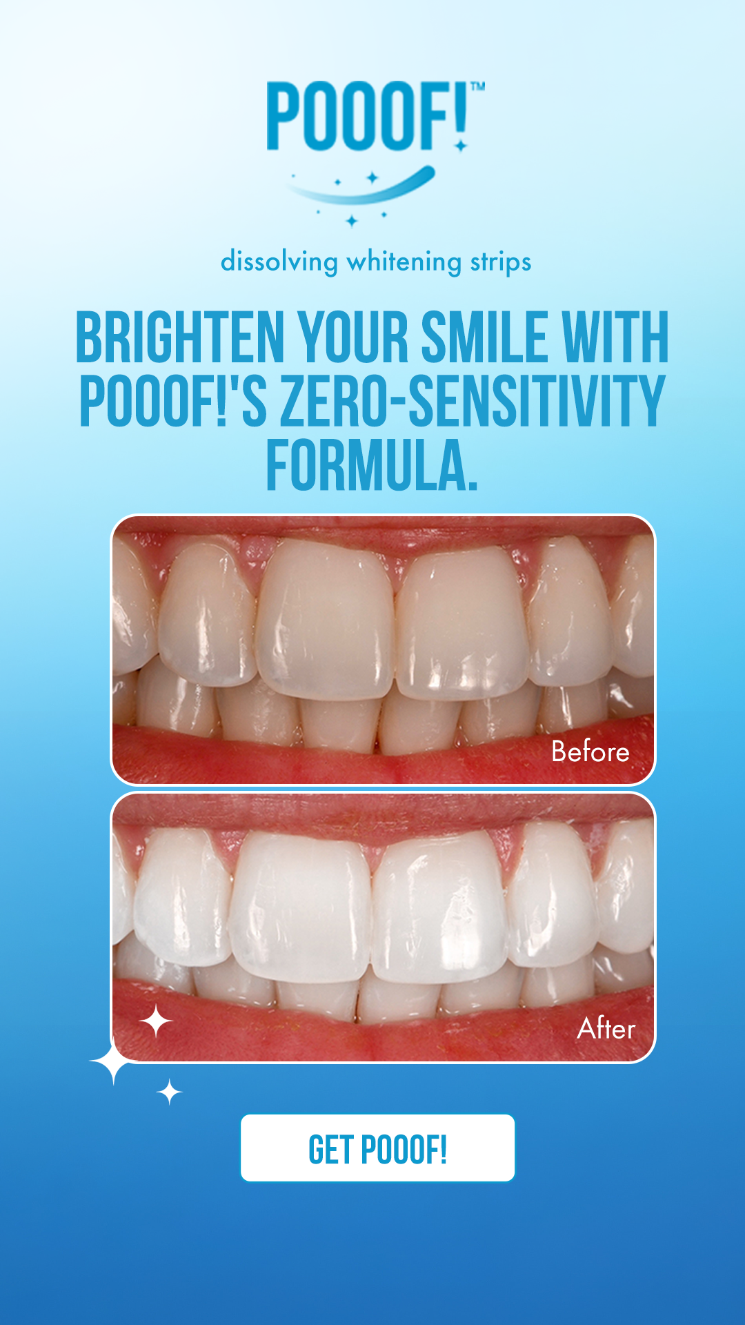 Pooof Whitening Facebook ad from Jan 29, 2026