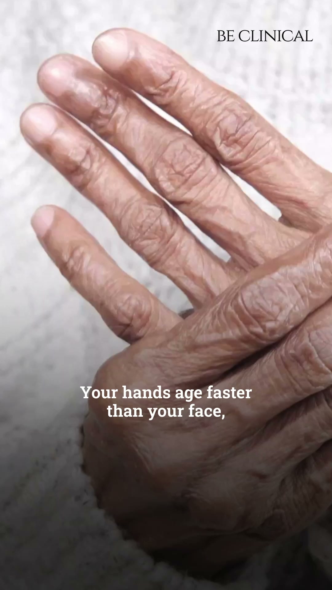 Be Clinical Facebook ad: Say Goodbye to Dry, Wrinkled Hands, Hello Youthful Softness!