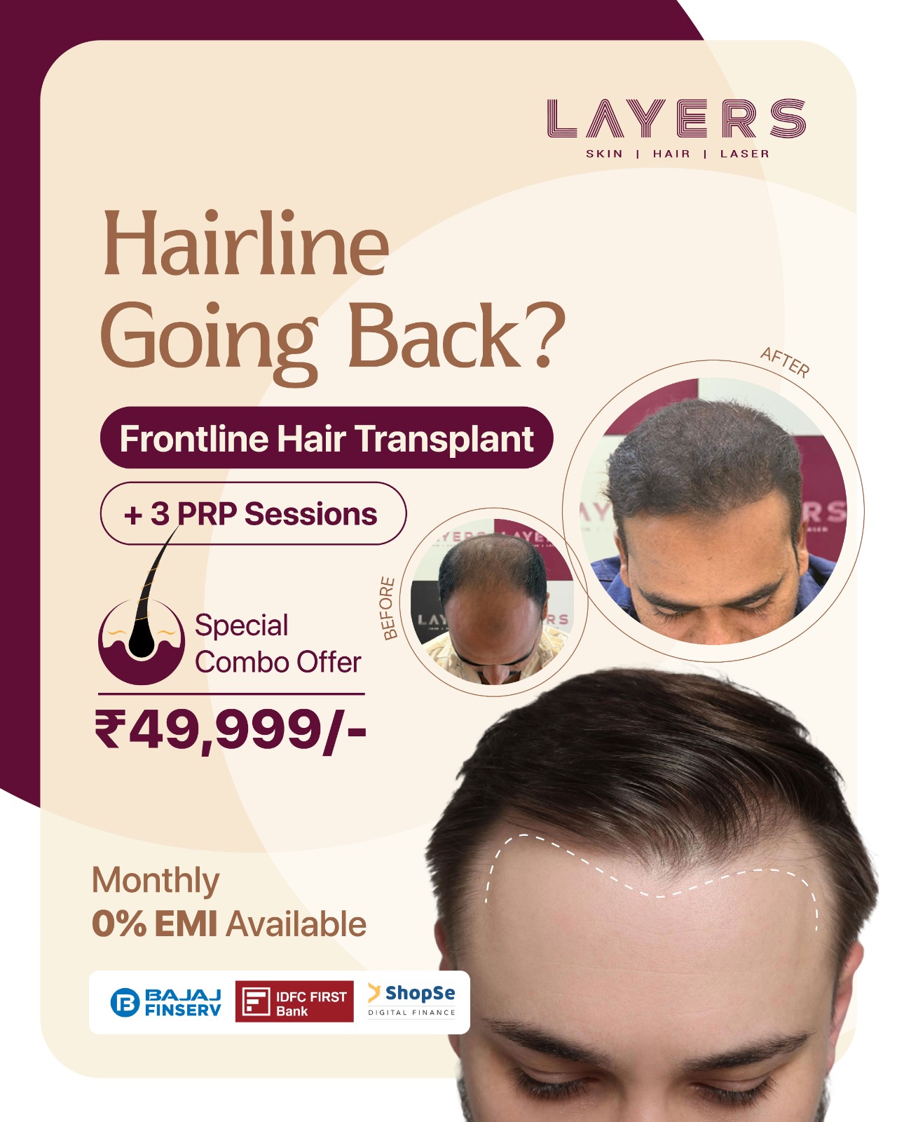 Layers Clinics - Skin & Hair Facebook ad