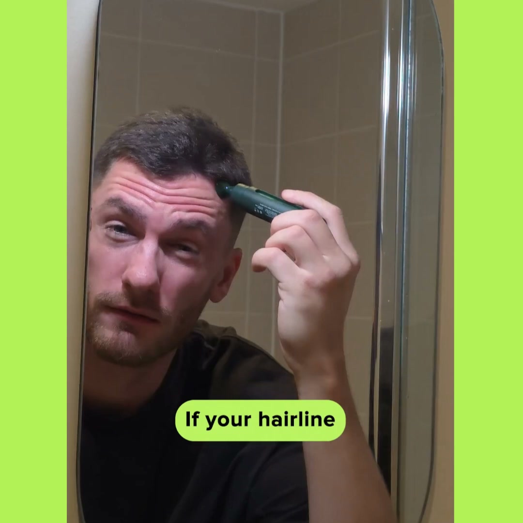 Scandinavian Biolabs Facebook ad: Your hairline back. Your confidence back.