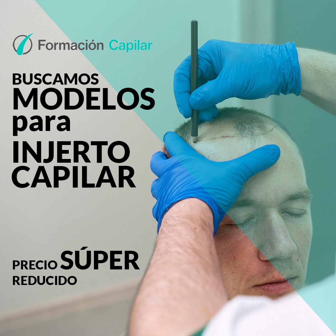 Formación Capilar Facebook ad