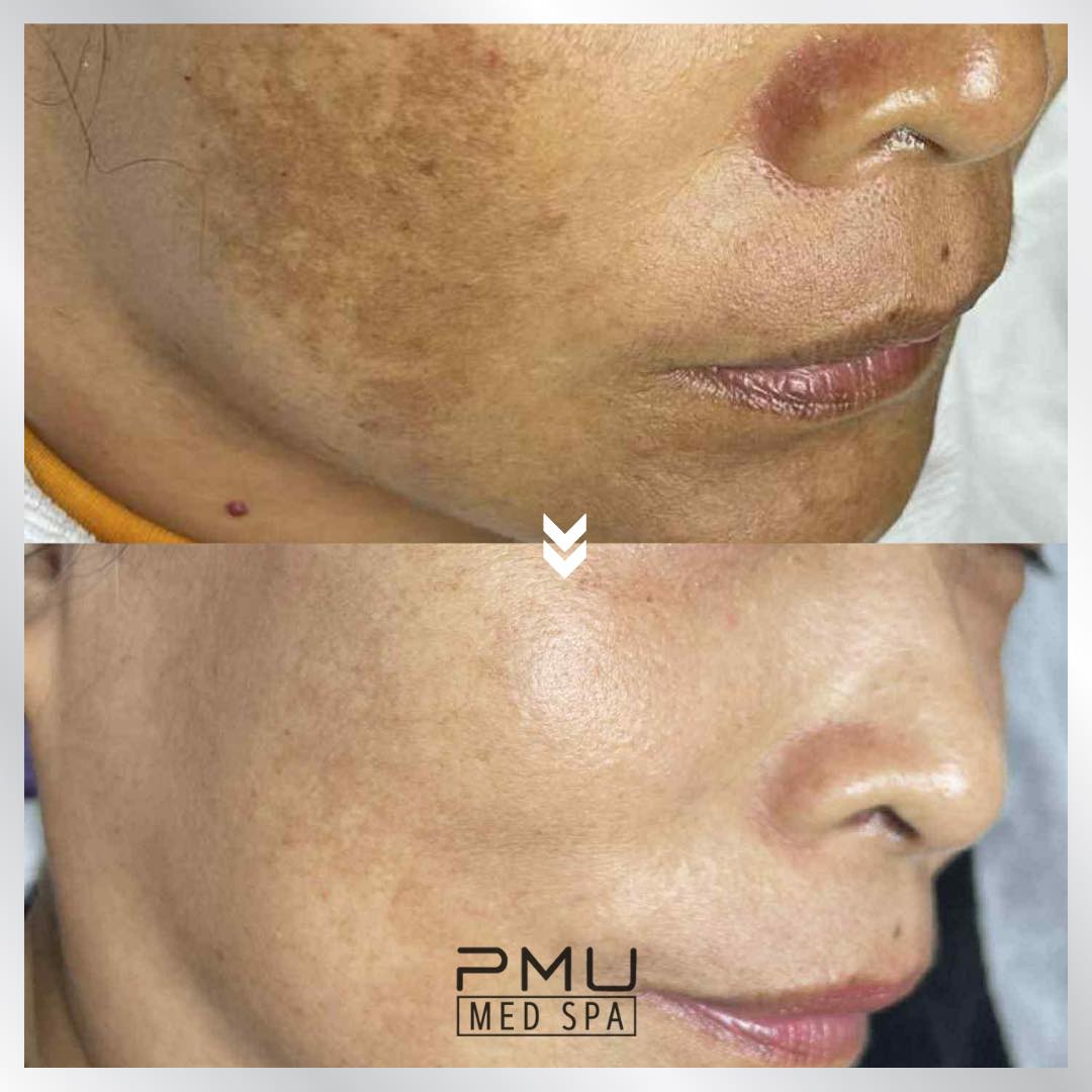 PMU MED SPA Facebook ad