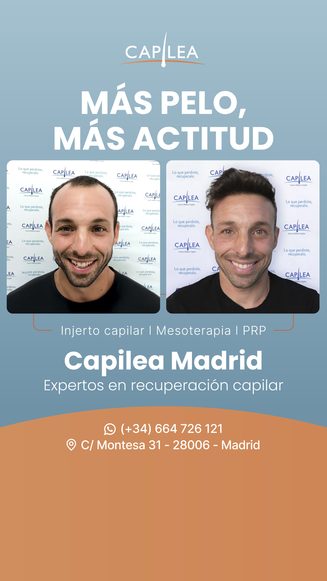 Capilea Madrid Facebook ad from Jan 21, 2026