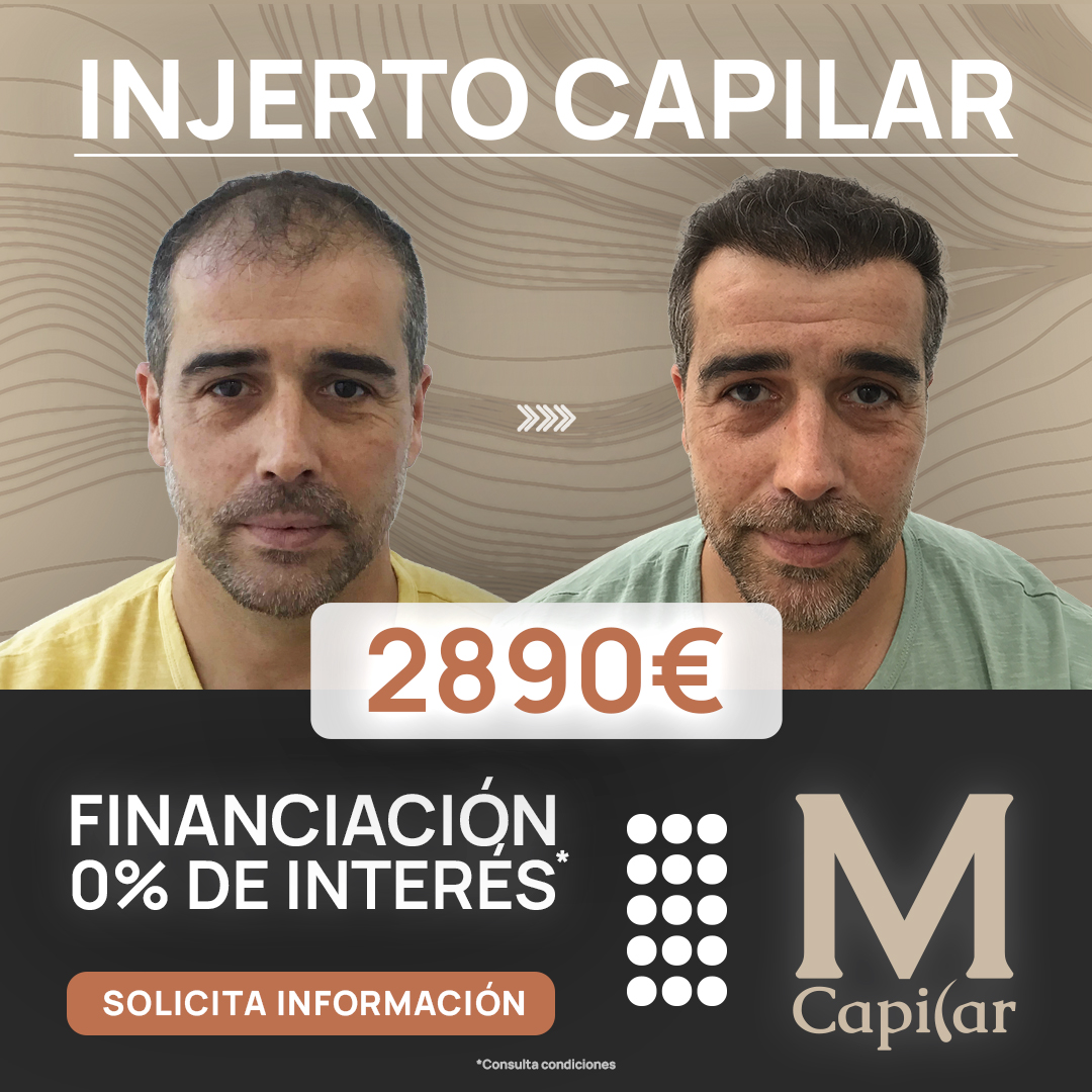 MCapilar Facebook ad