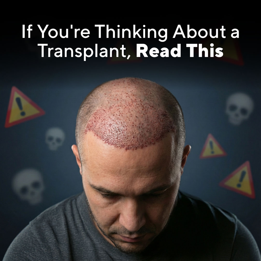 Dr. Jake Platt, Trichologist Facebook ad: The Strongest Hair-Growth Product