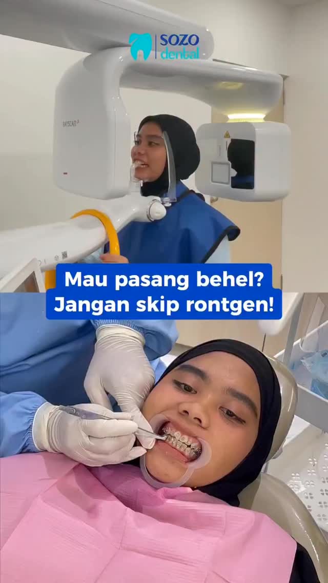 Sozo Dental Clinic Facebook ad: Sebelum pasang behel, kamu wajib rontgen dulu!