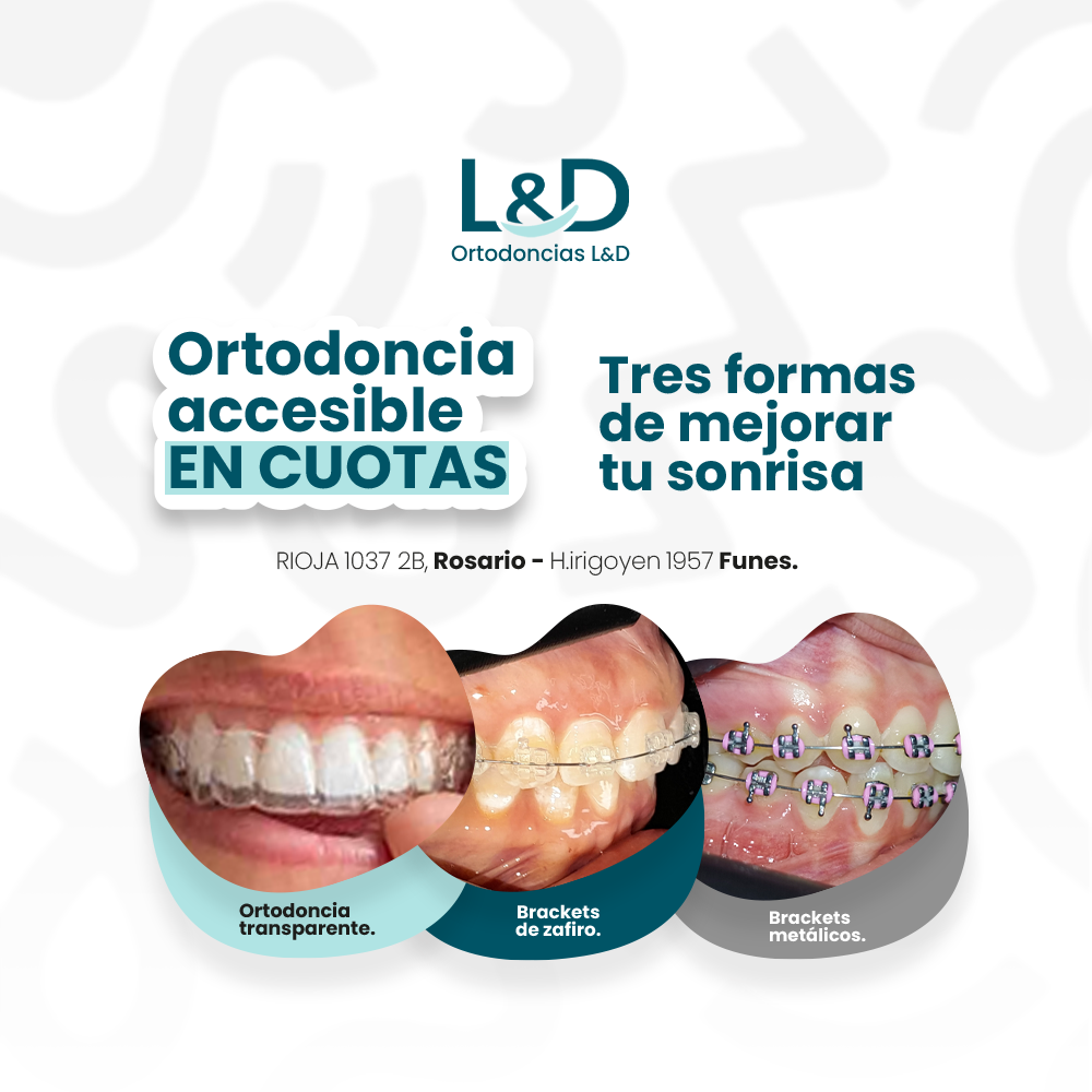Ortodoncias LyD Facebook ad