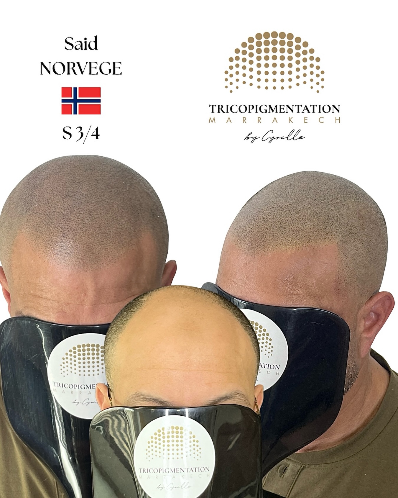 Tricopigmentation Marrakech. Facebook ad: Chat with us