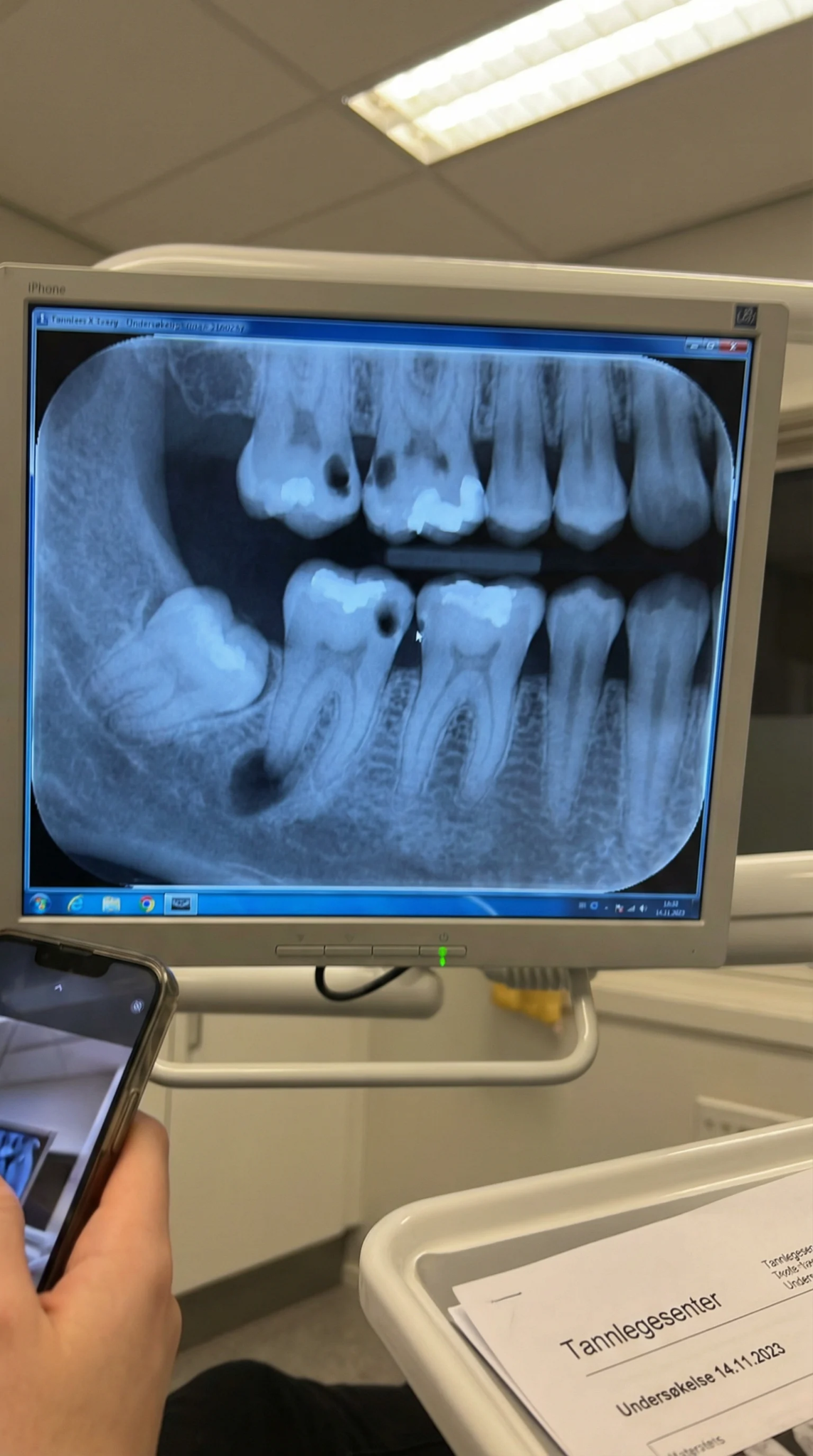 Dentura.no Facebook ad: Røntgenbildet viste det jeg ikke kunne se.