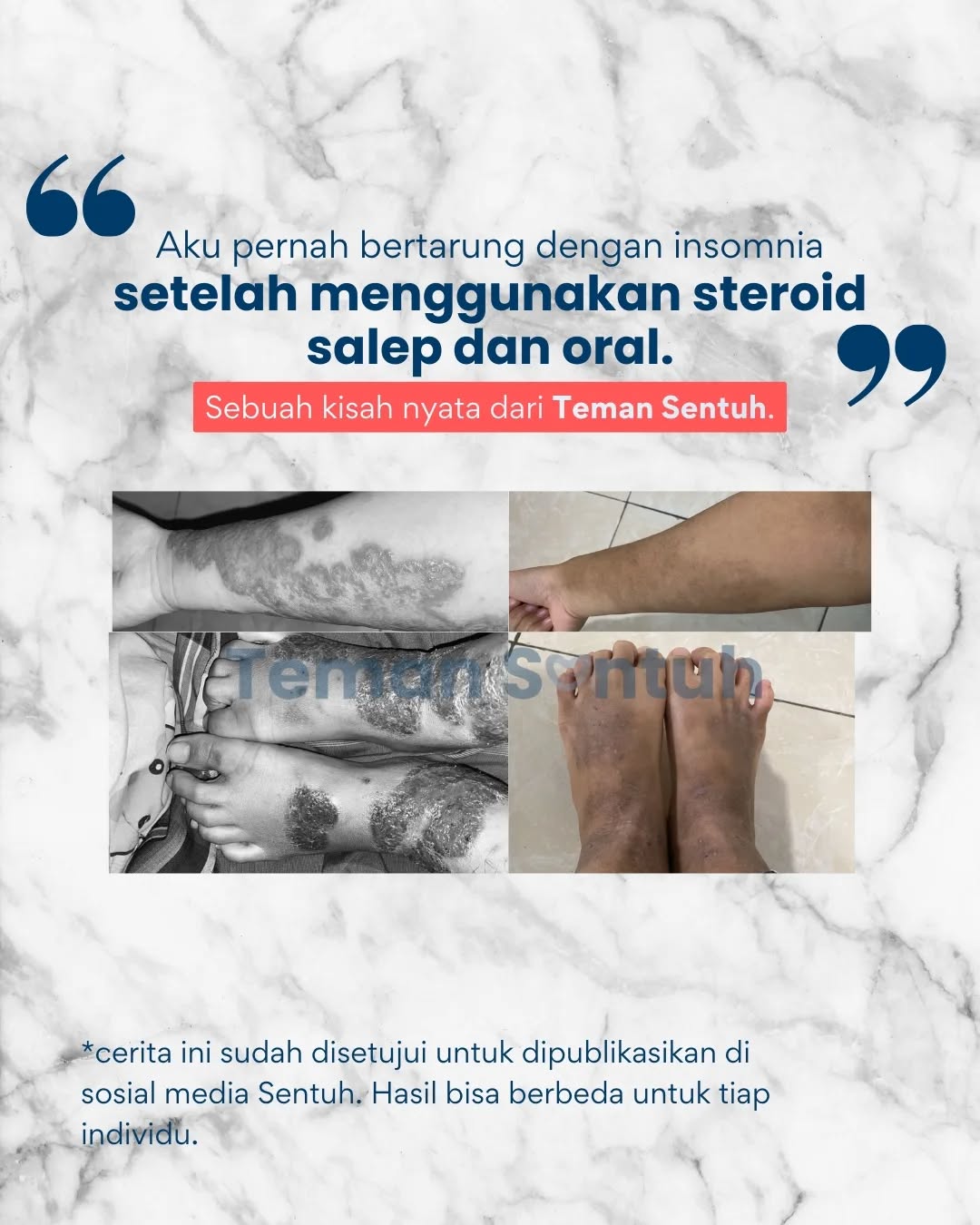 sentuh__ Facebook ad