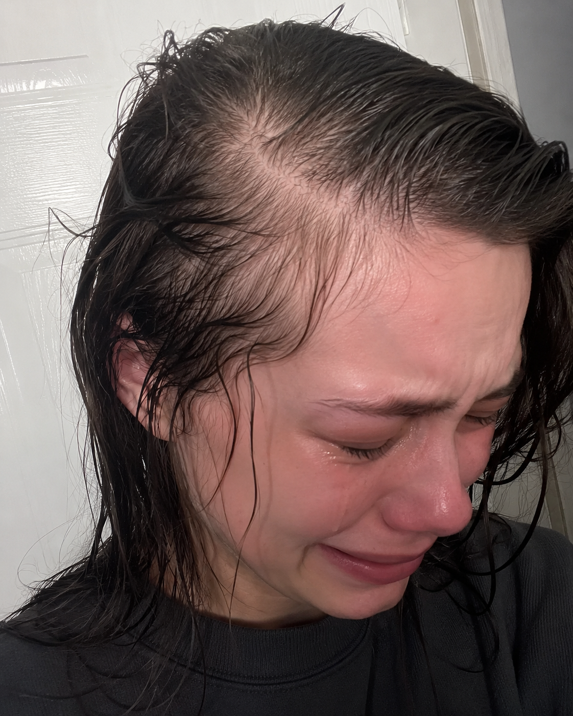 Laura Bennett Facebook ad: Fix Your GLP-1 Hair Loss Today