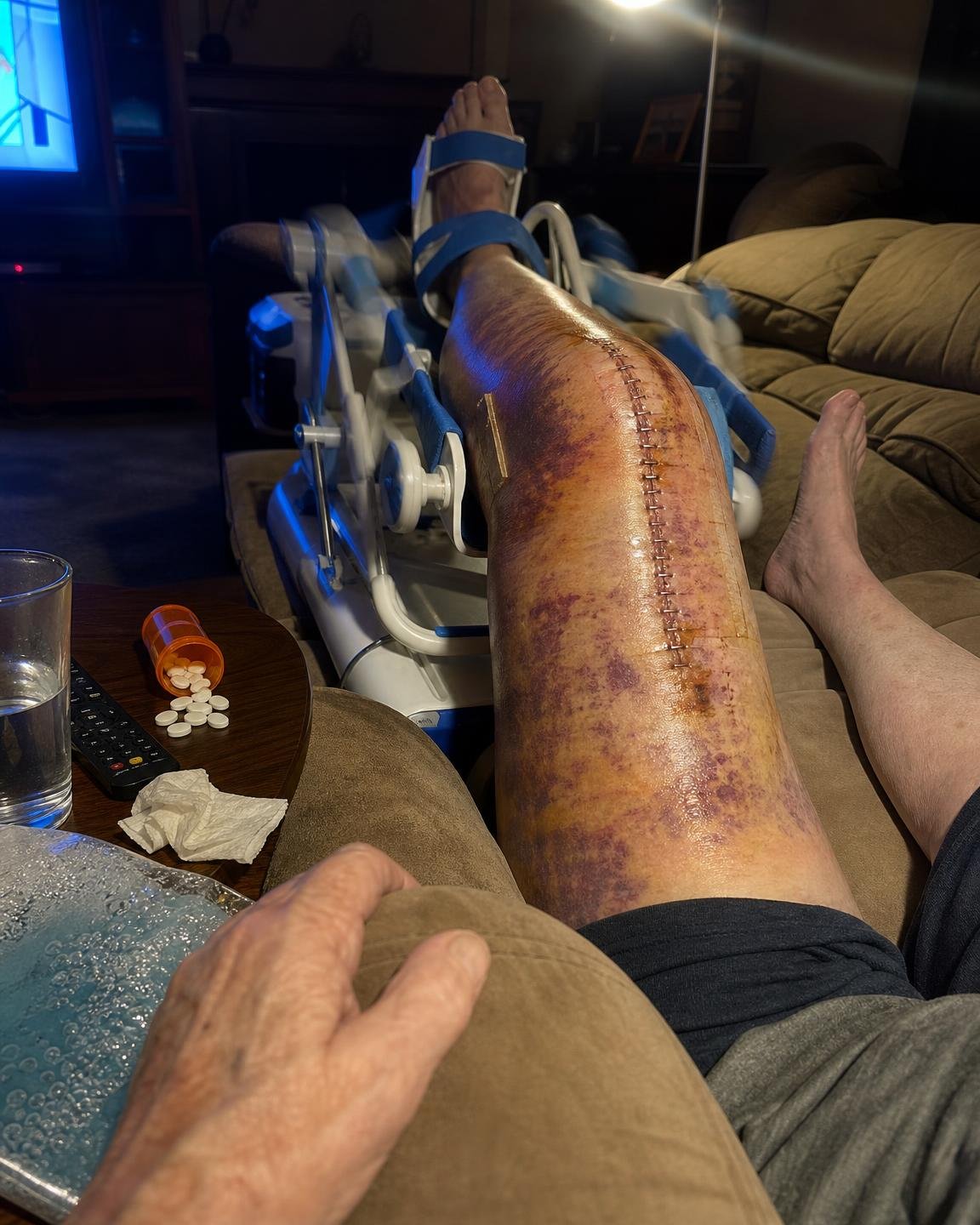 Linda Baker Facebook ad: 12 years of bone-on-bone knee pain gone in 2 days?