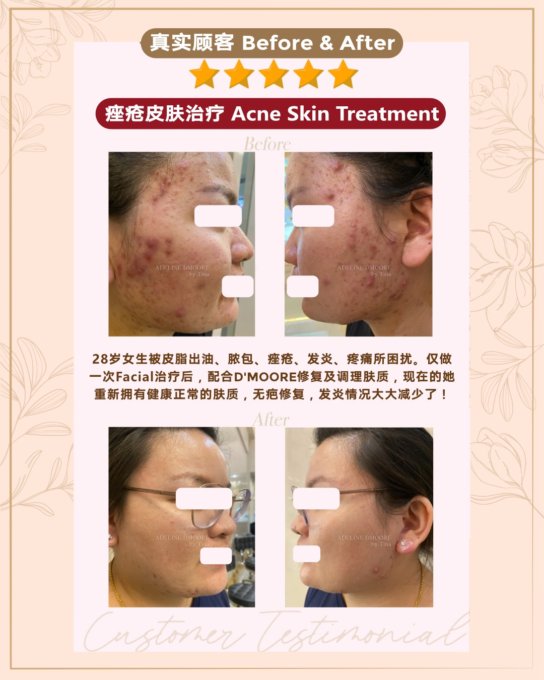 D'moore 蓓蕾逖慕丽专科美容美体机构 Facebook ad