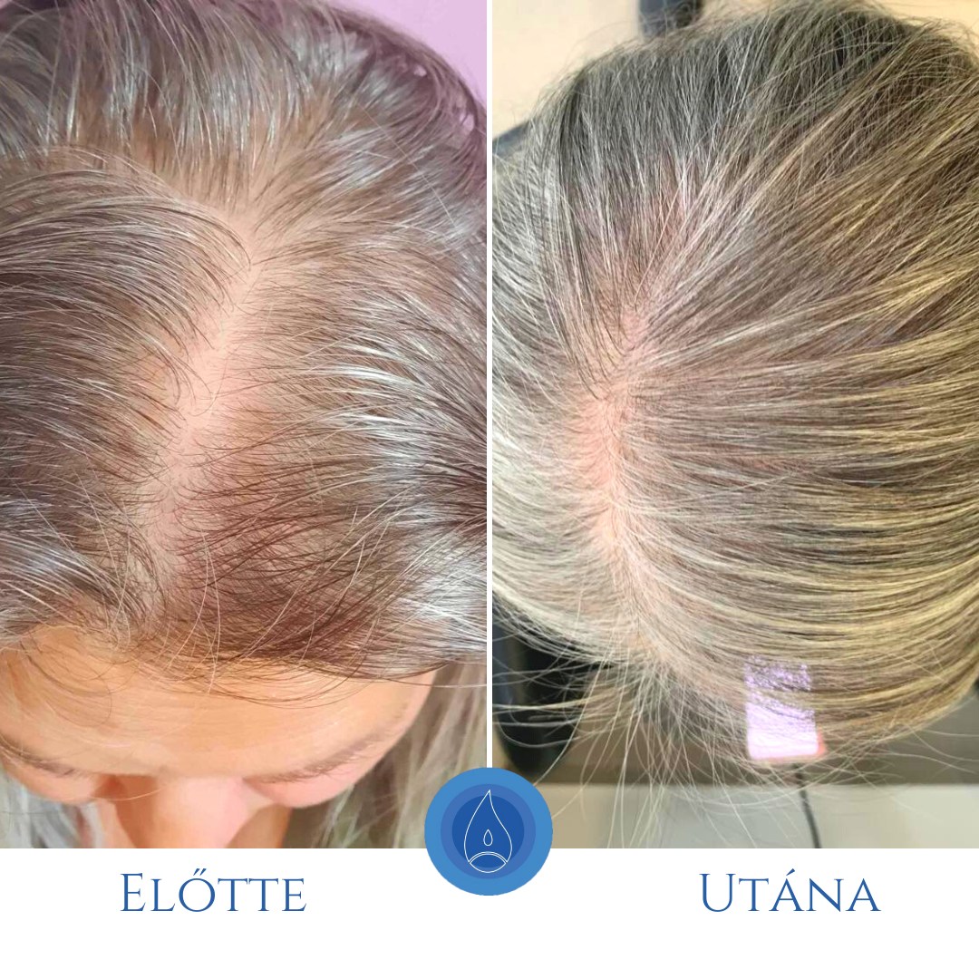 Oxygeni Hair & Skin Hajgyógyász és Bőrterápia Szalon Győr Facebook ad