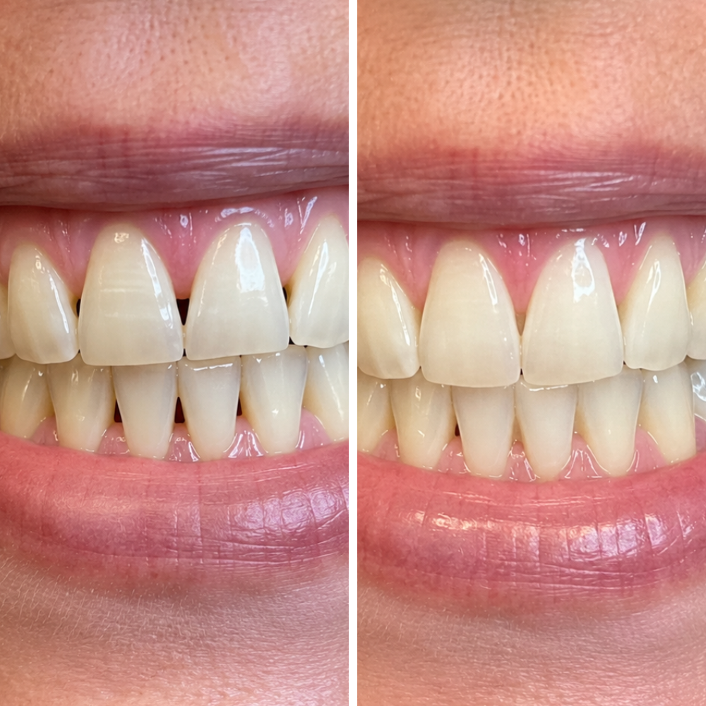 Beatrice Warren Facebook ad: Receding Gums? Read This NOW