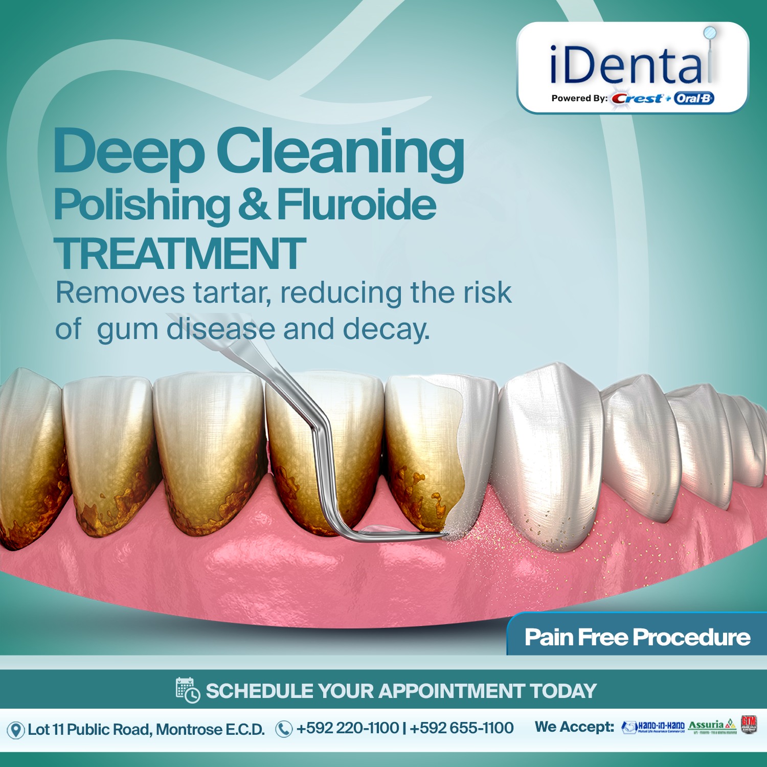 iDental Inc. Facebook ad: Refresh your smile with our Deep Cleaning, Polishing…