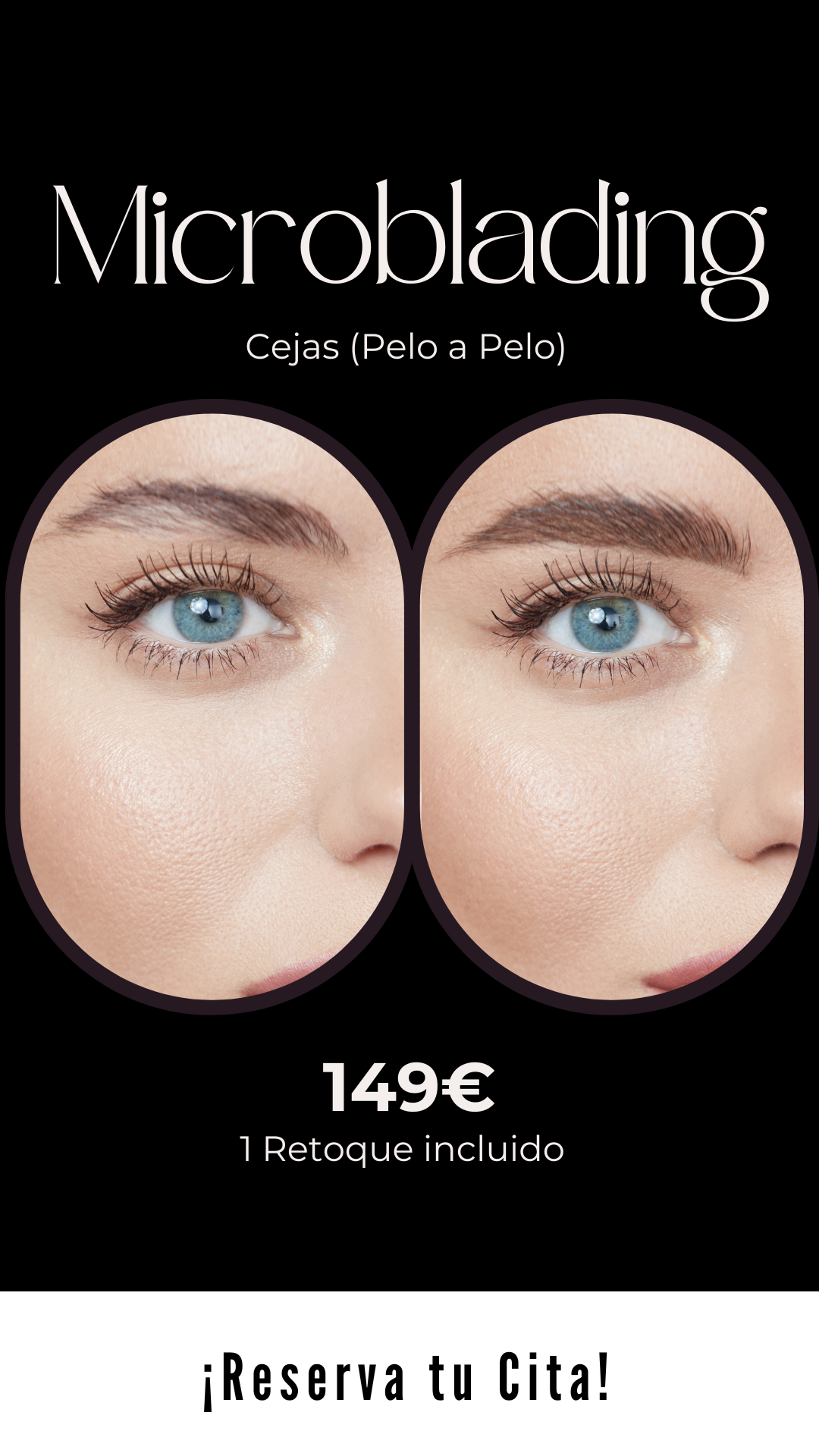Centro Estética Avanzada VB en Alicante Facebook ad