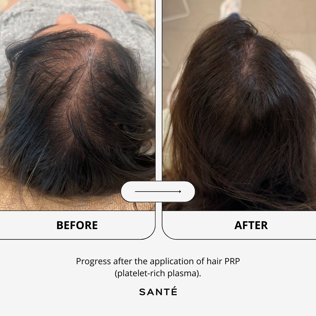 SANTÉ Clínica Estética Facebook ad