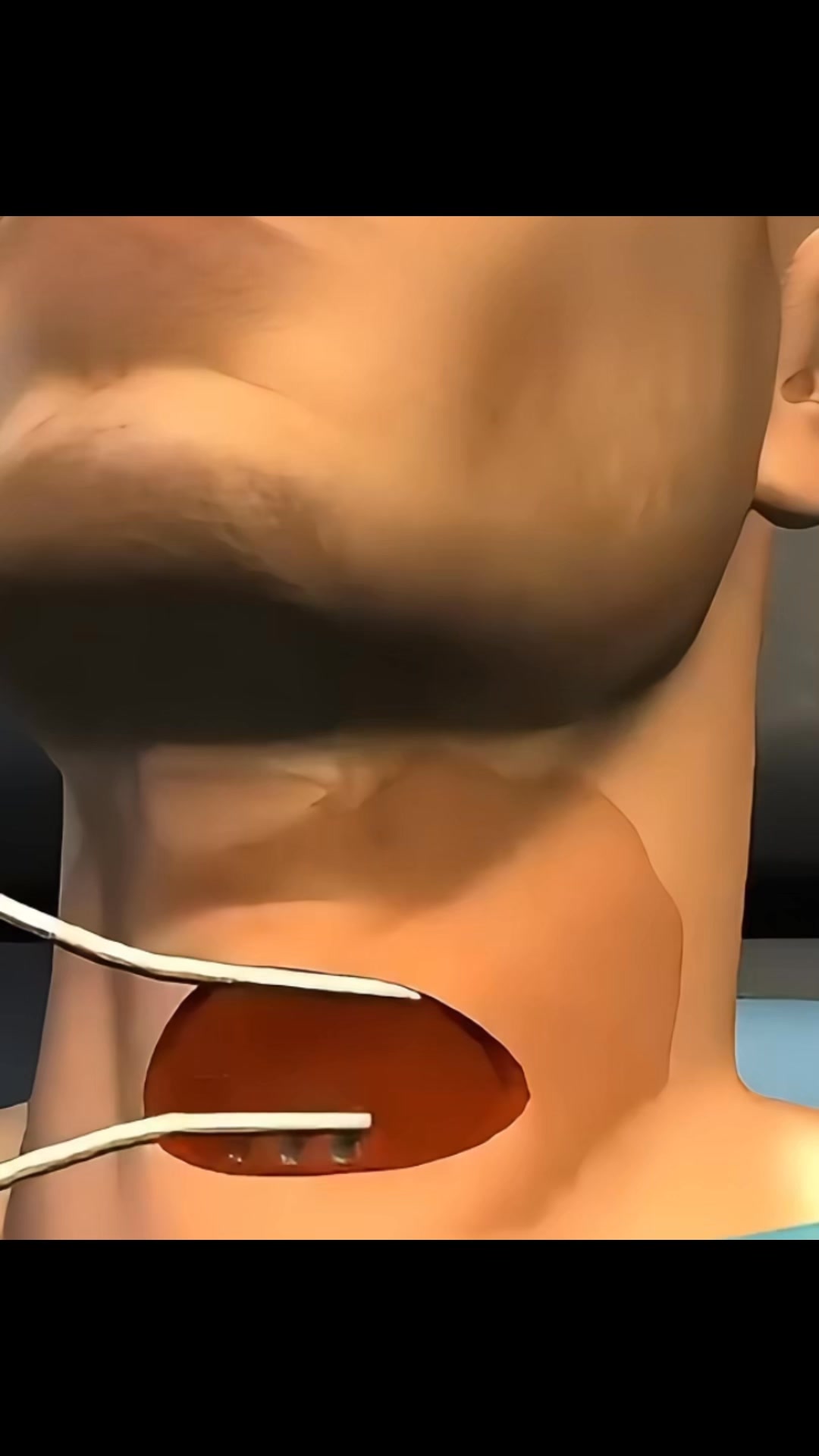 Keller Health Facebook ad: Sag Tschüss zu Nackenschmerzen, Sofortige Hilfe für Zuhause