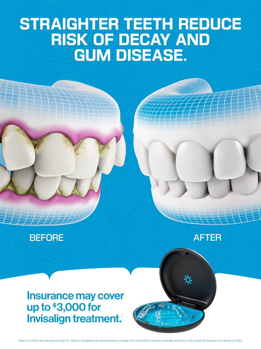 Invisalign Facebook ad: Find Your Local Invisalign Doctor Today!