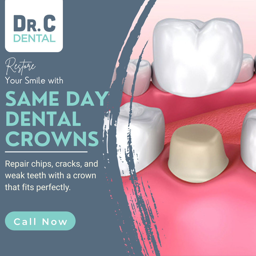 Dr. C Dental South Hill Facebook ad: Get a Permanent Crown in Just One Visit