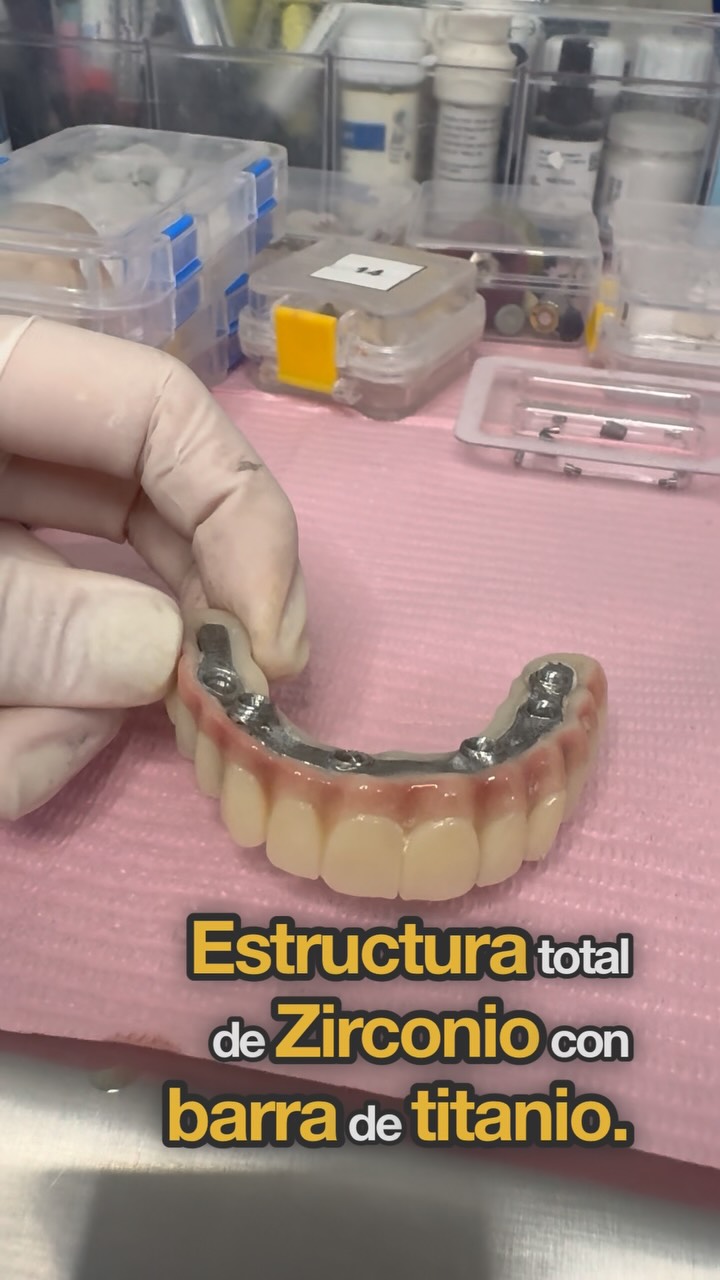 Clinica Dental Zenit Las Condes Facebook ad: Aquí te mostramos cómo reemplazamos dientes y encía…
